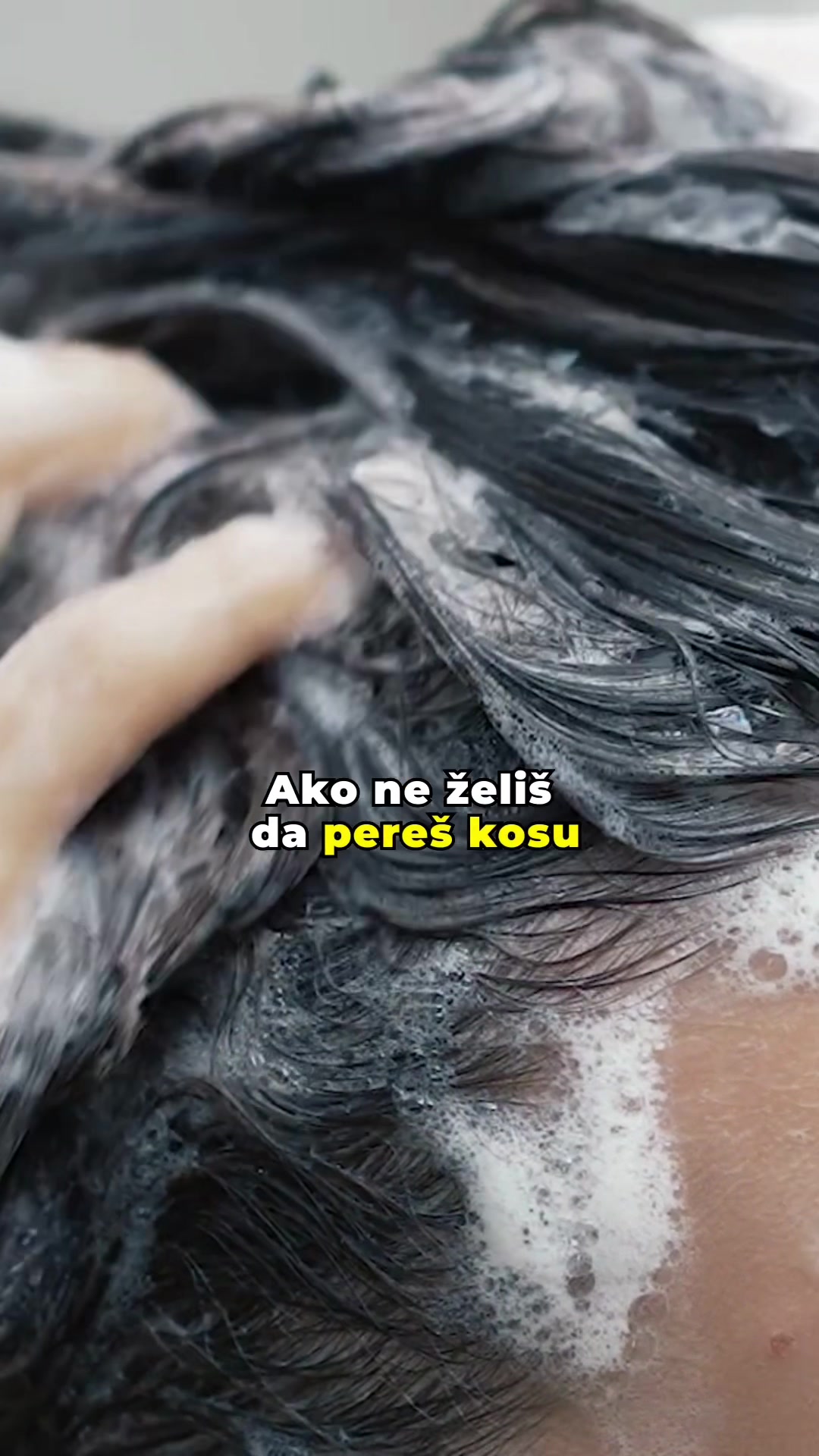 @RAST KOSE | ❌ OPADANJA
