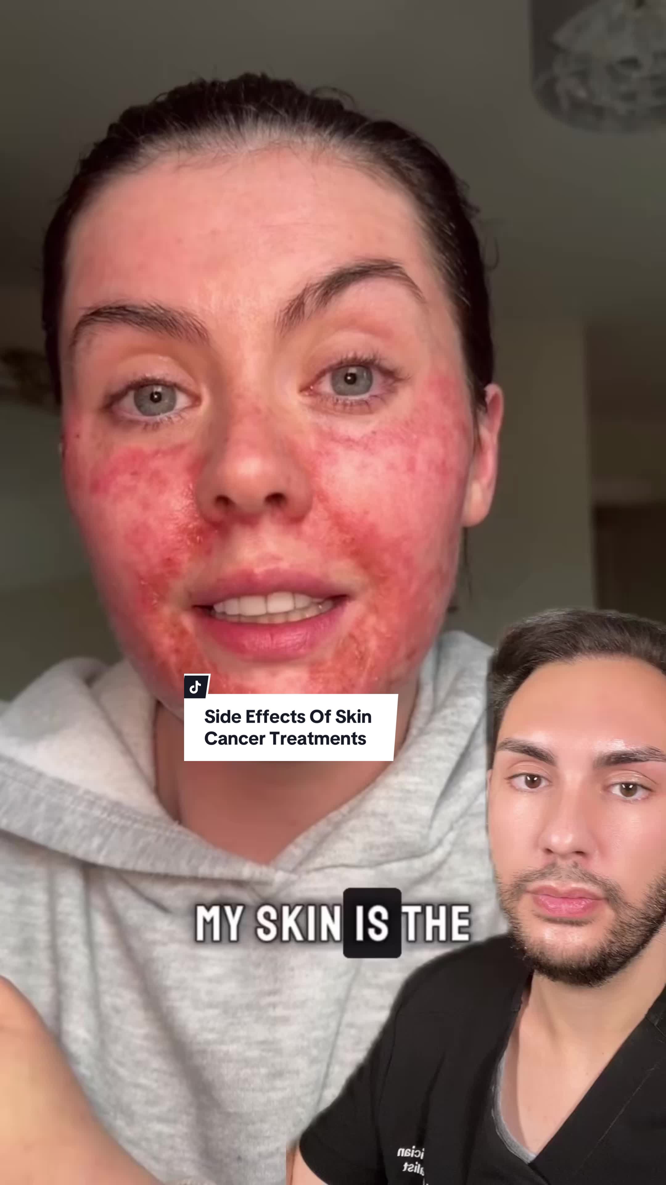 @Justin | Dermatology Nurse🇨🇦