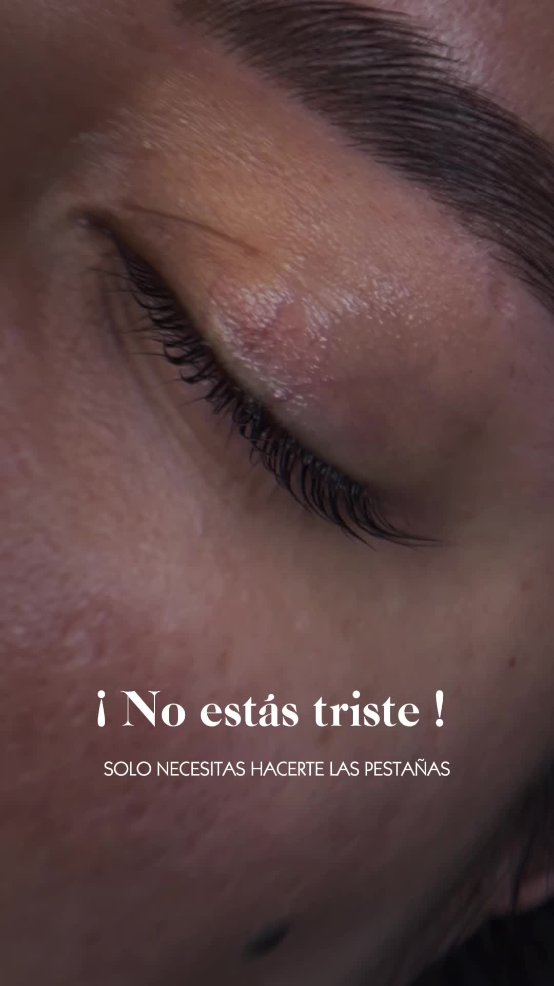 @Nalle Marlo
