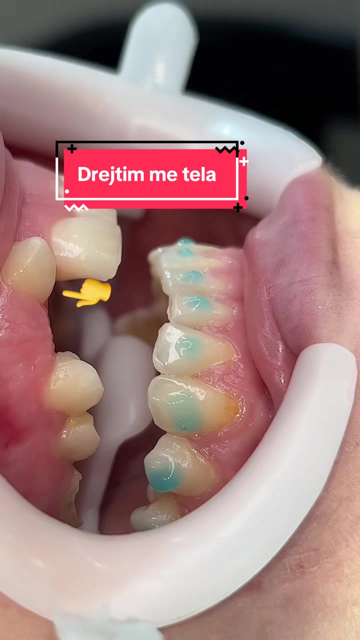 @Smile family