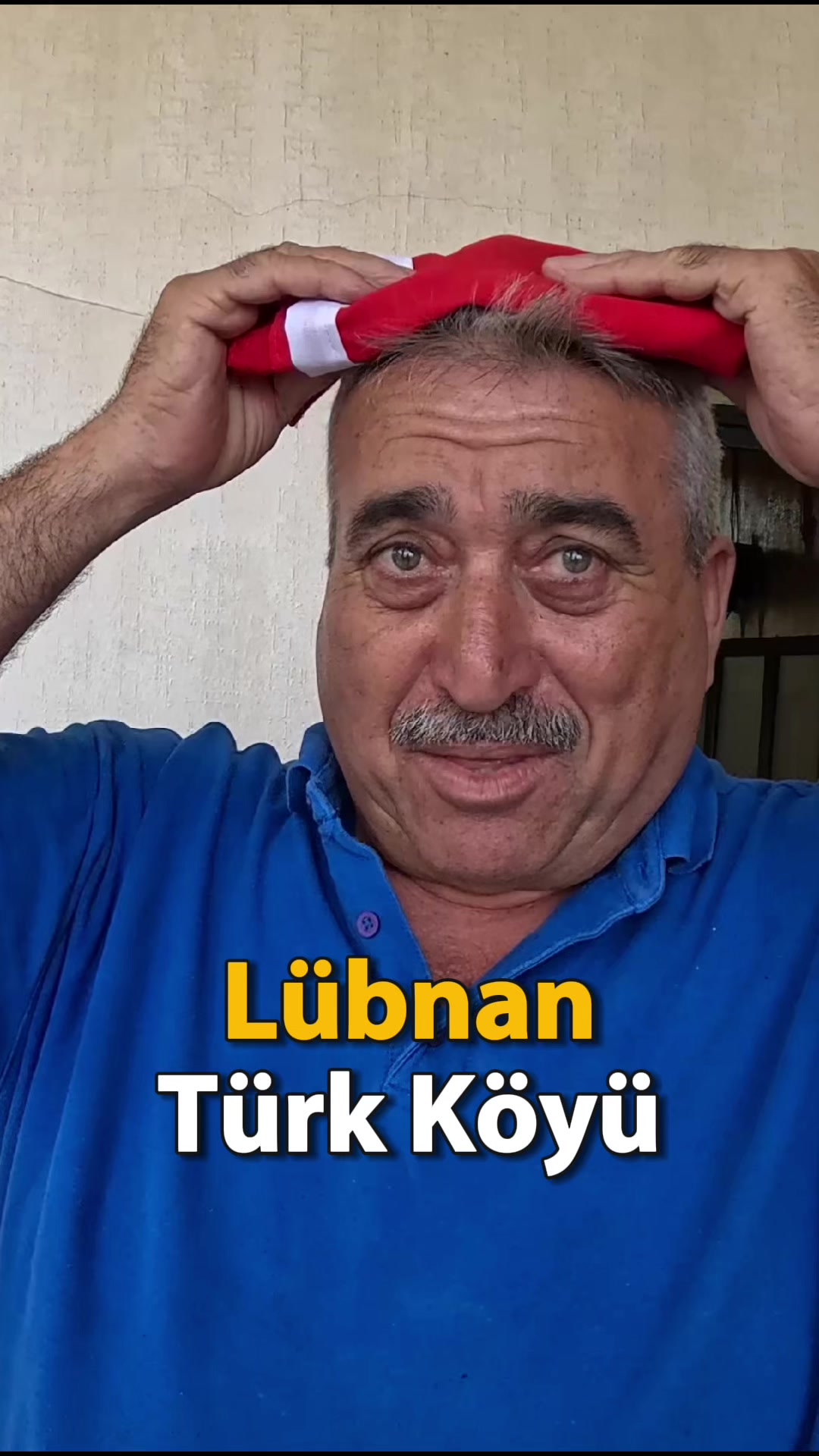 @Burak Durgun