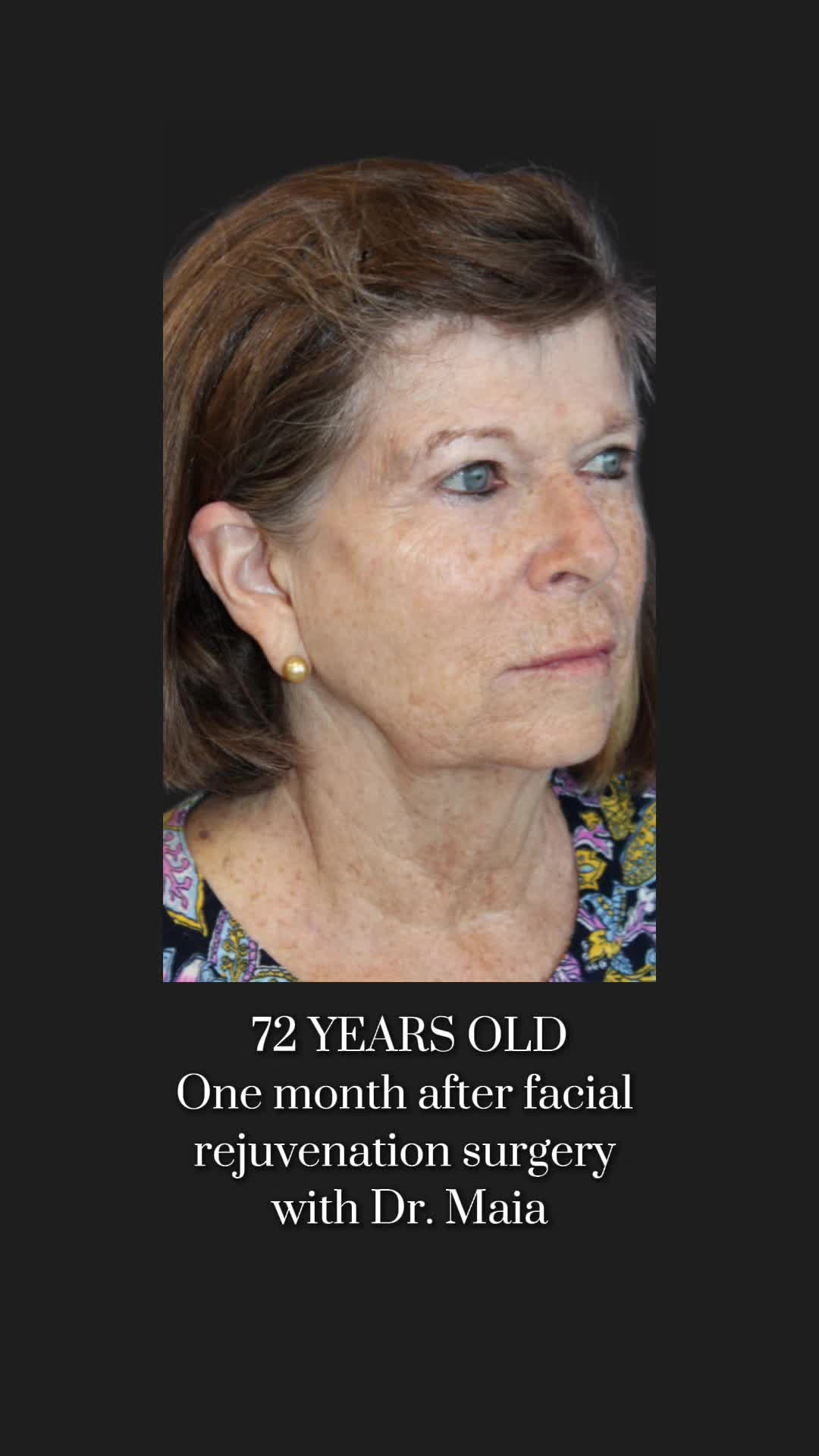 @Dr. Maia | Plastic Surgeon