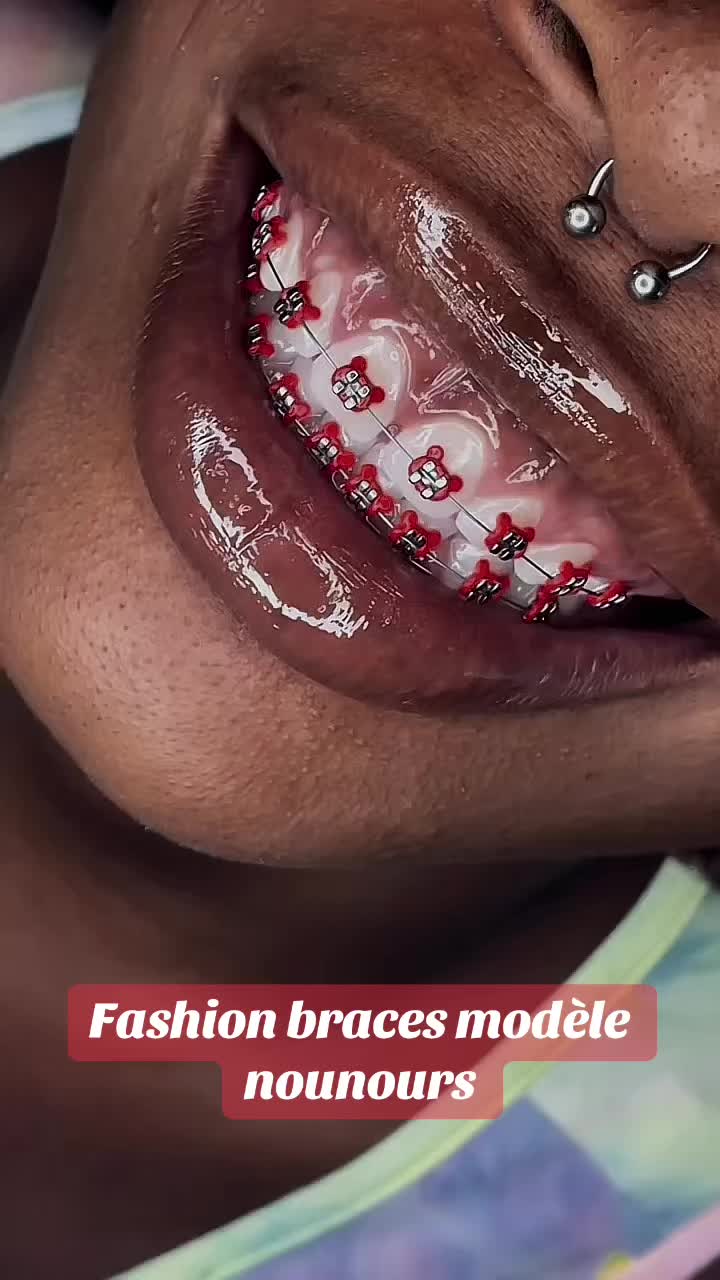 @MG.braces237