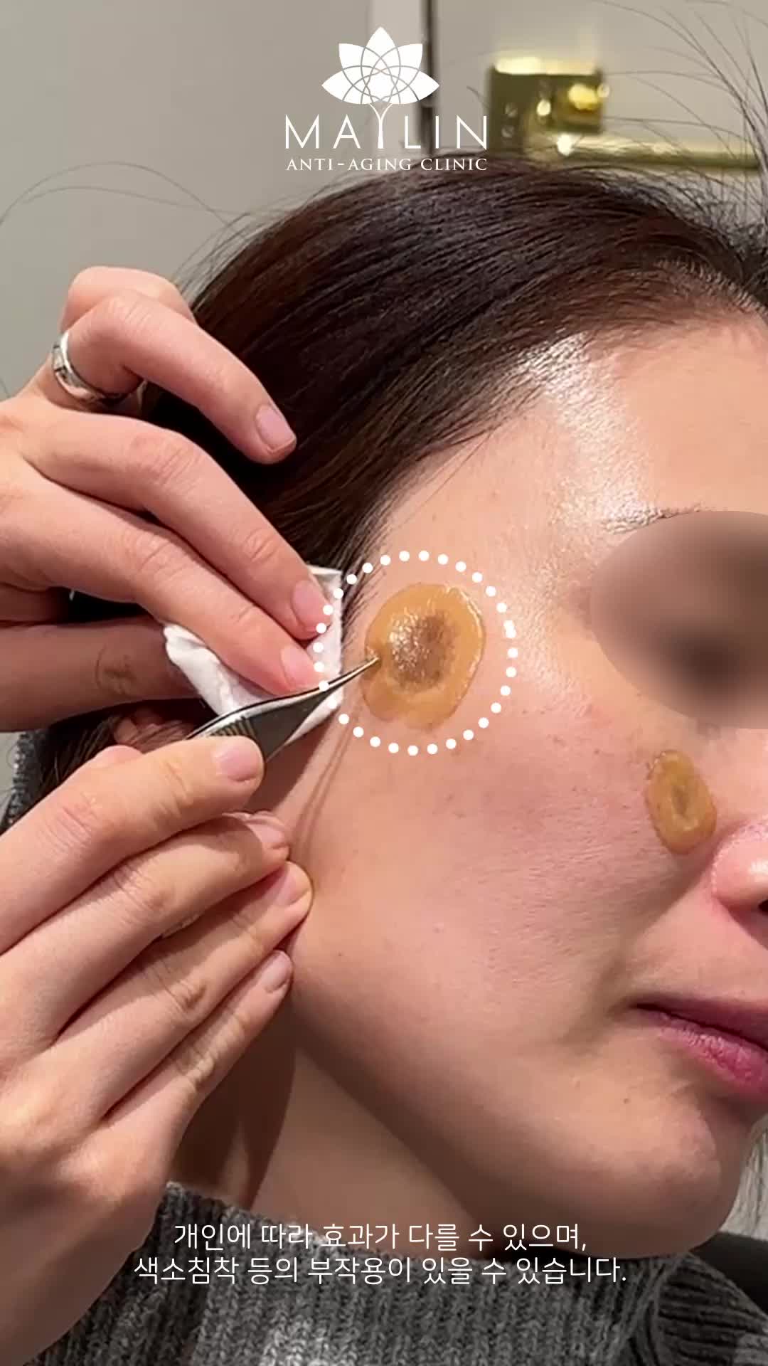 @메이린의원대구점