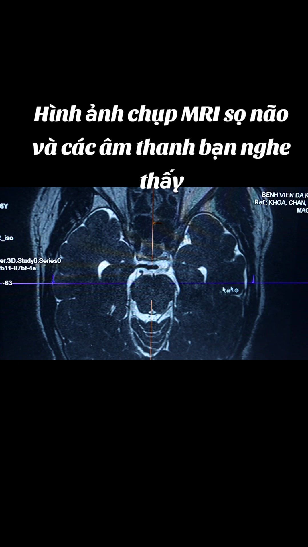 @Nguyễn Văn T&ugrave;ng