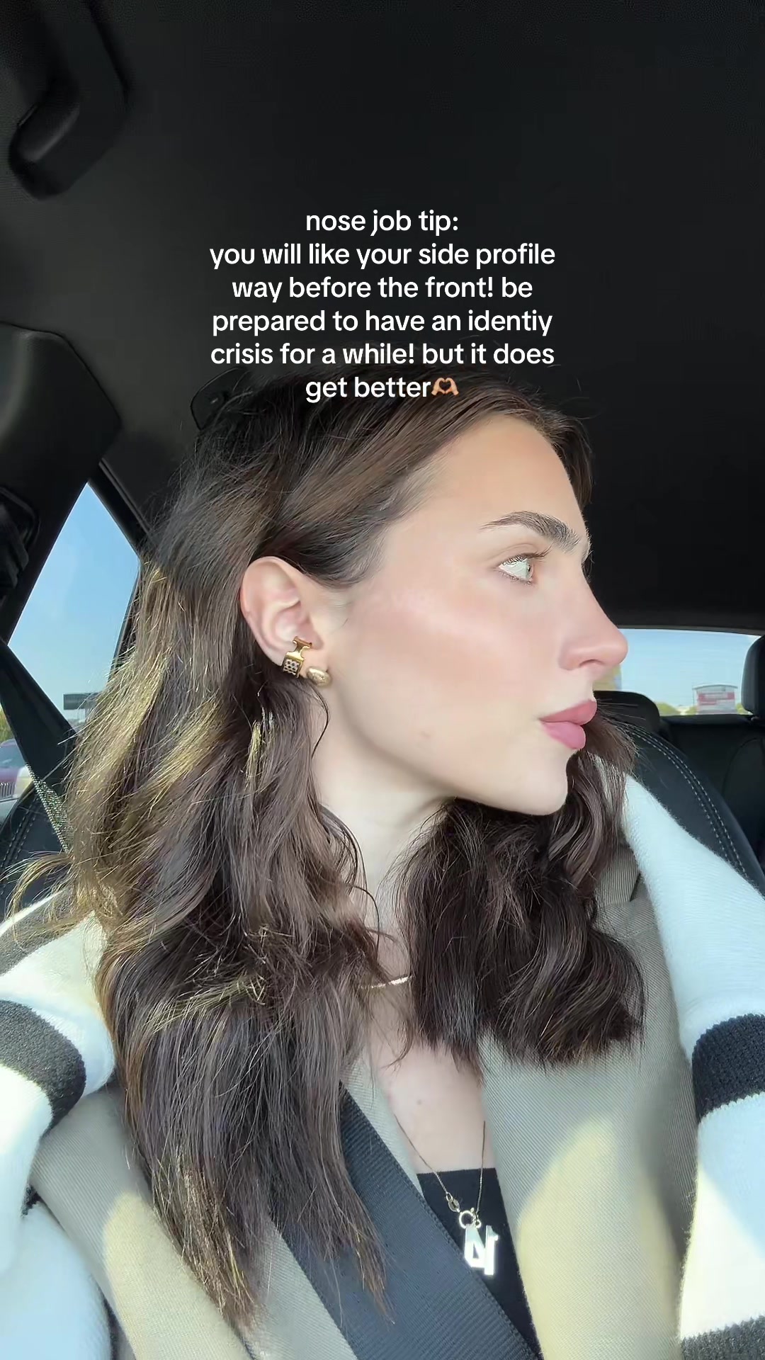 @Alexa Gantz