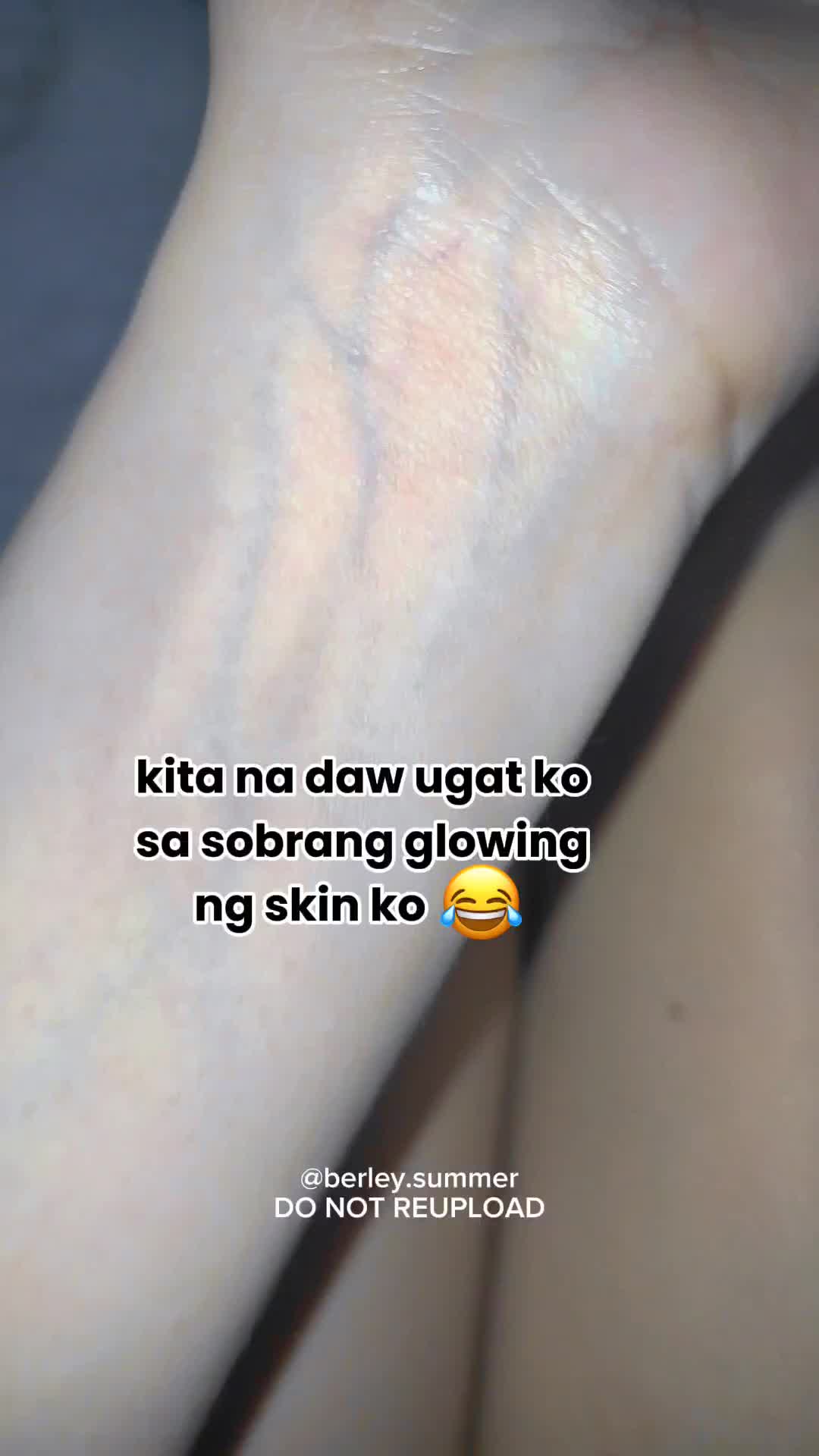 @Berley Summer