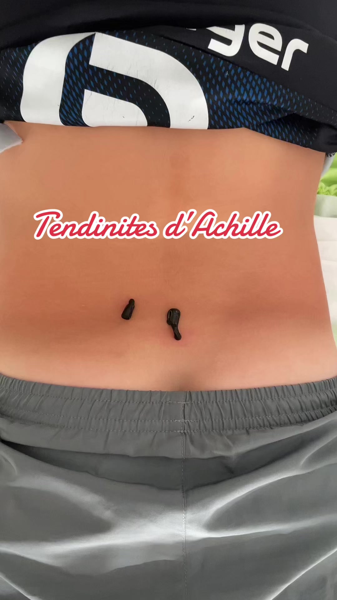 @Emyphysio🌺