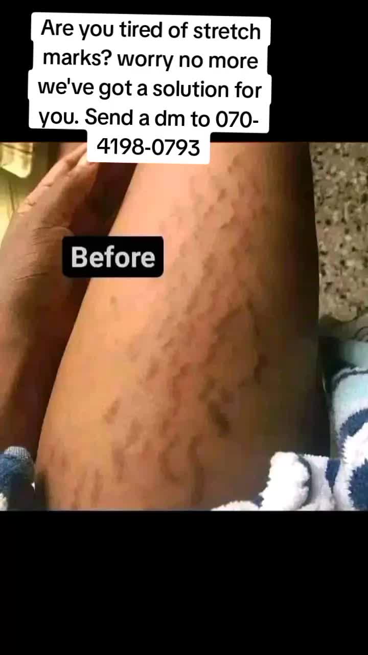 @EstinikBeautySecrets