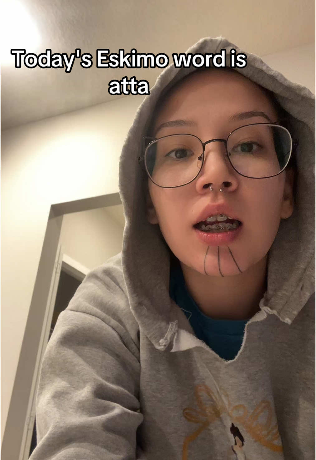 @Anna Viner