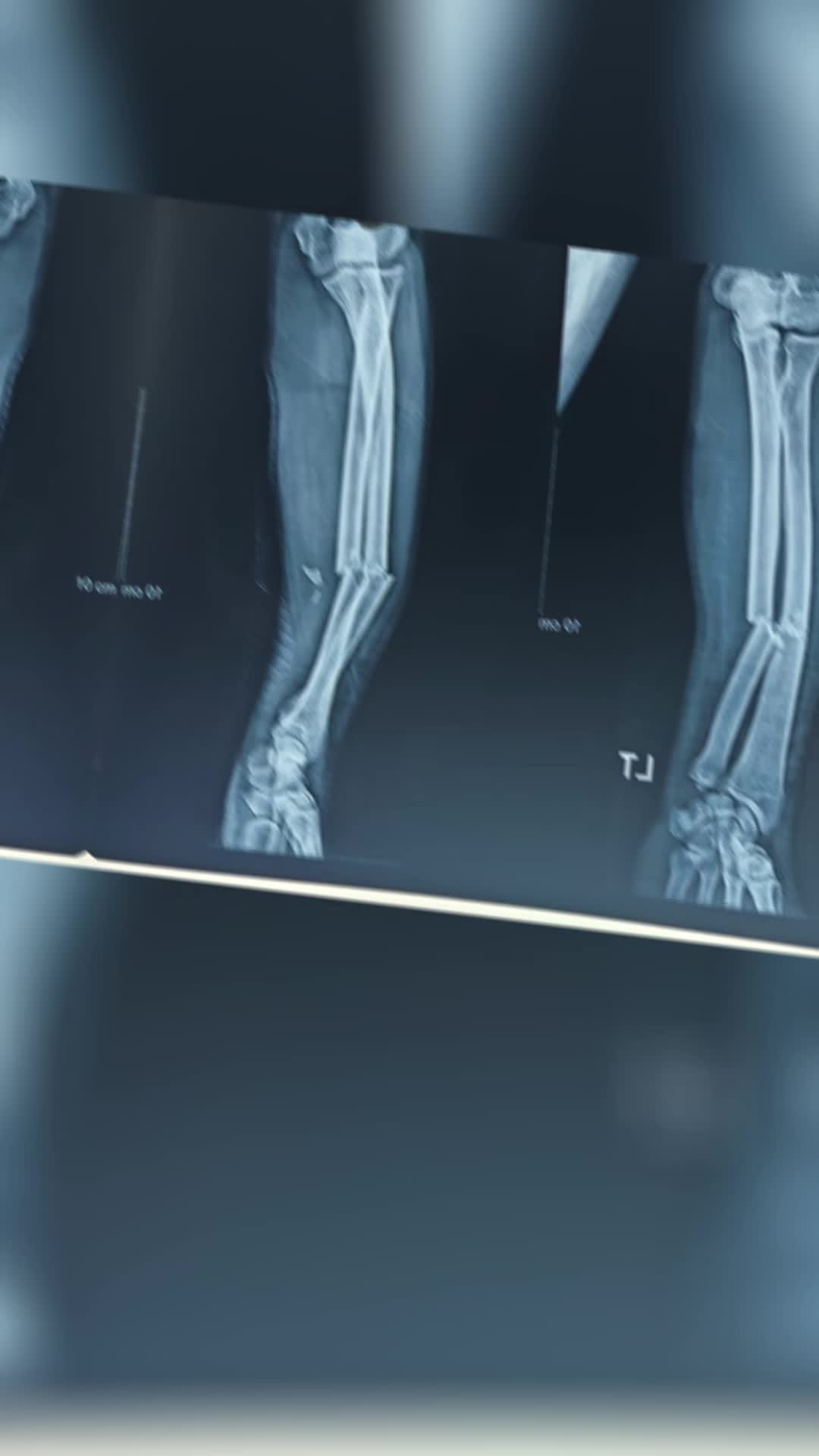 @Orthopedic_Surgeon_Arbind