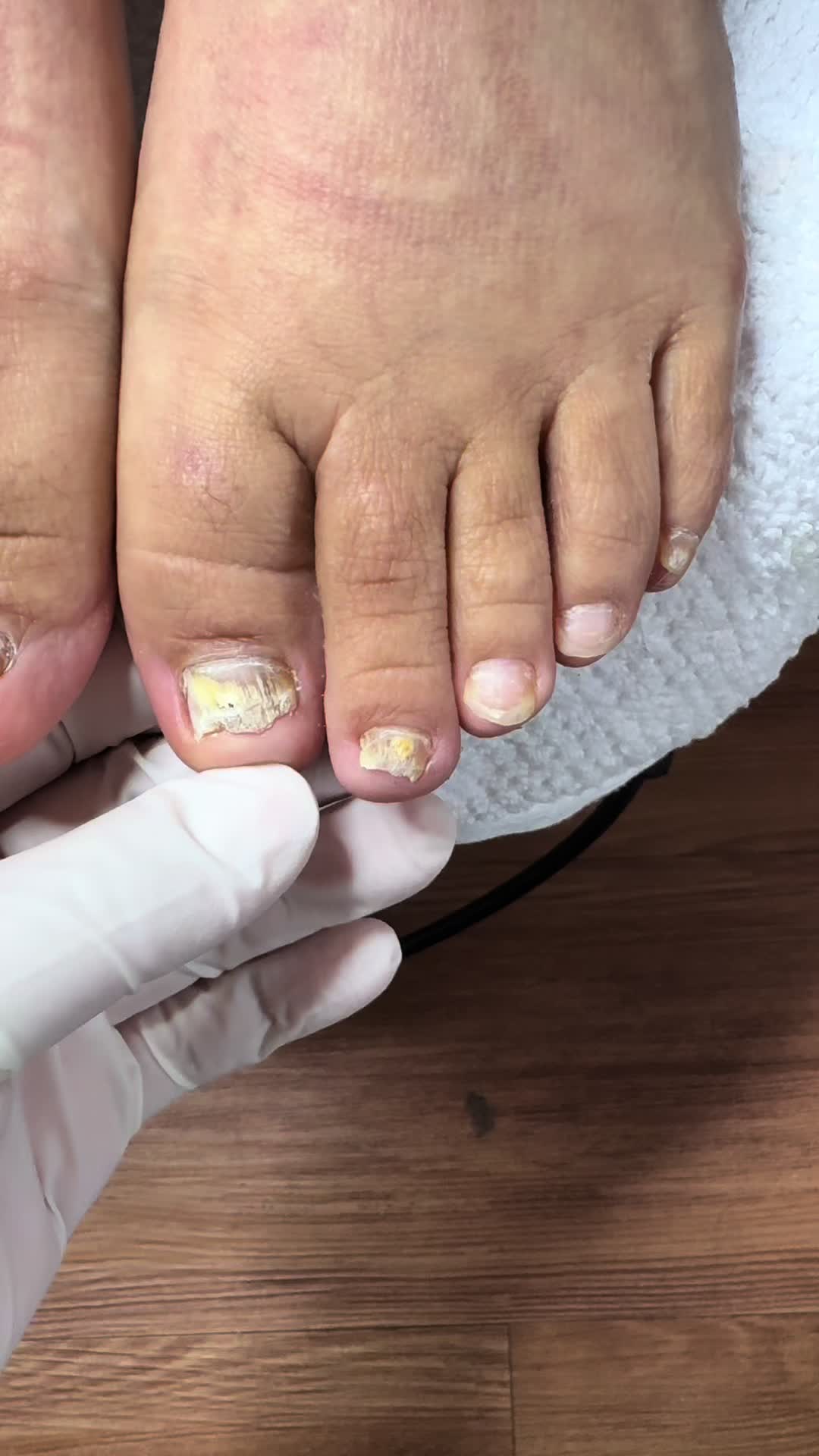 @ToesbyKoki