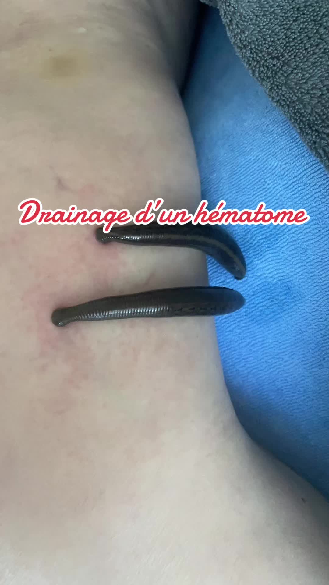 @Emyphysio🌺