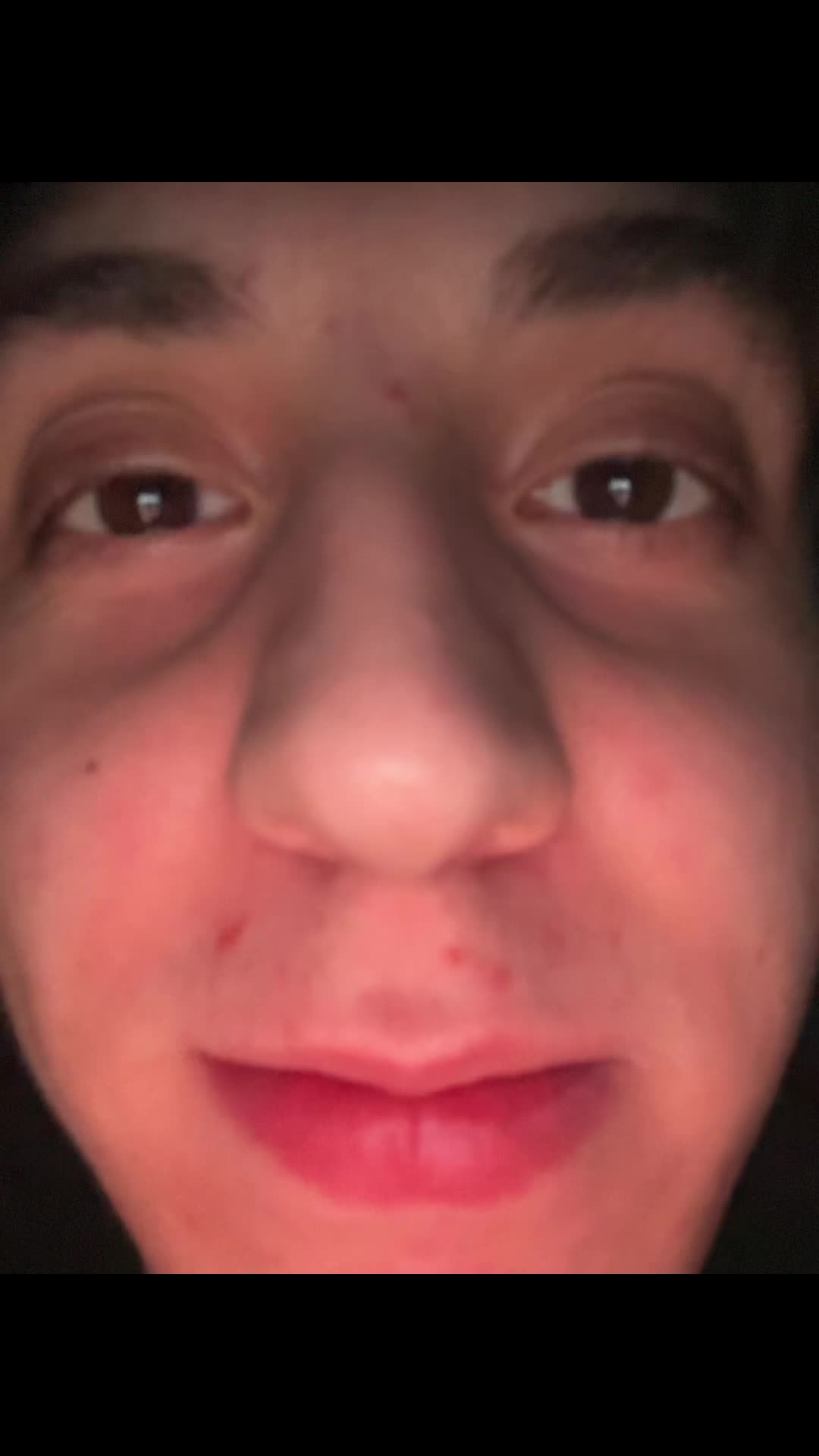 @Bidon