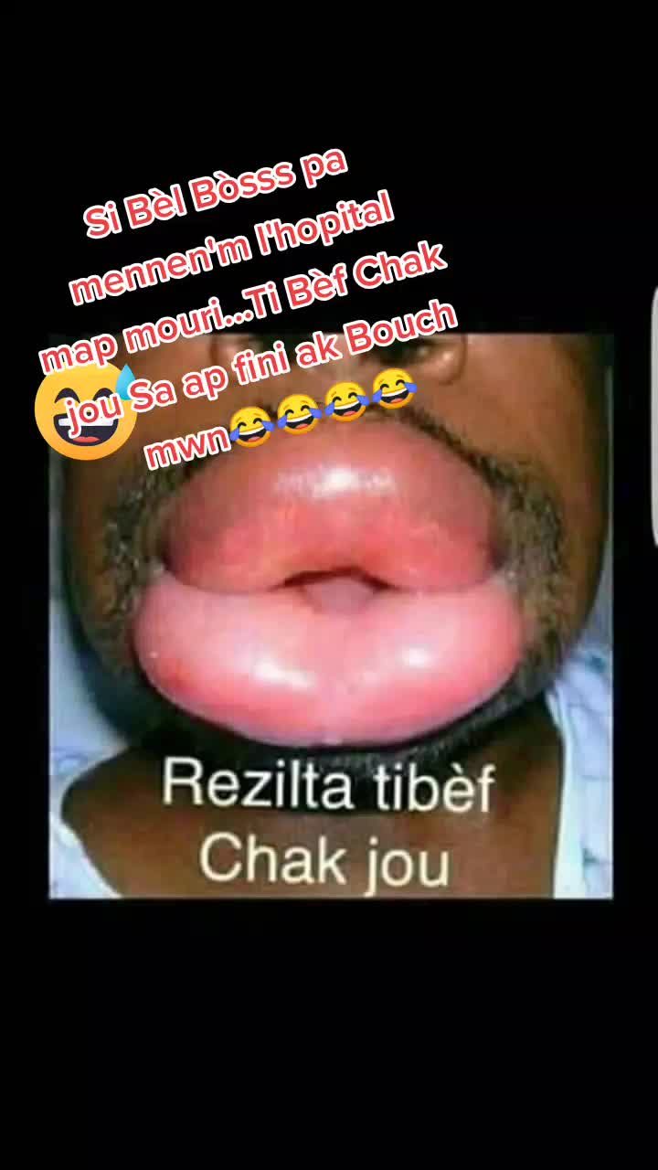 @Alteromelouinette fanm Okay la