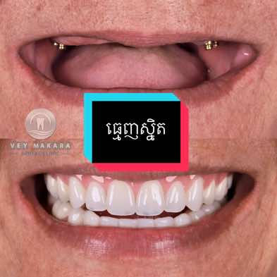 @គ្លីនិកធ្មេញវ័យមករា