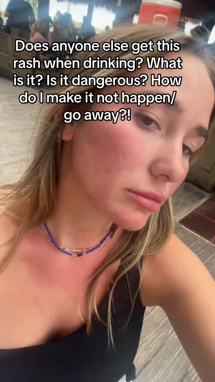 @Elise Rogers