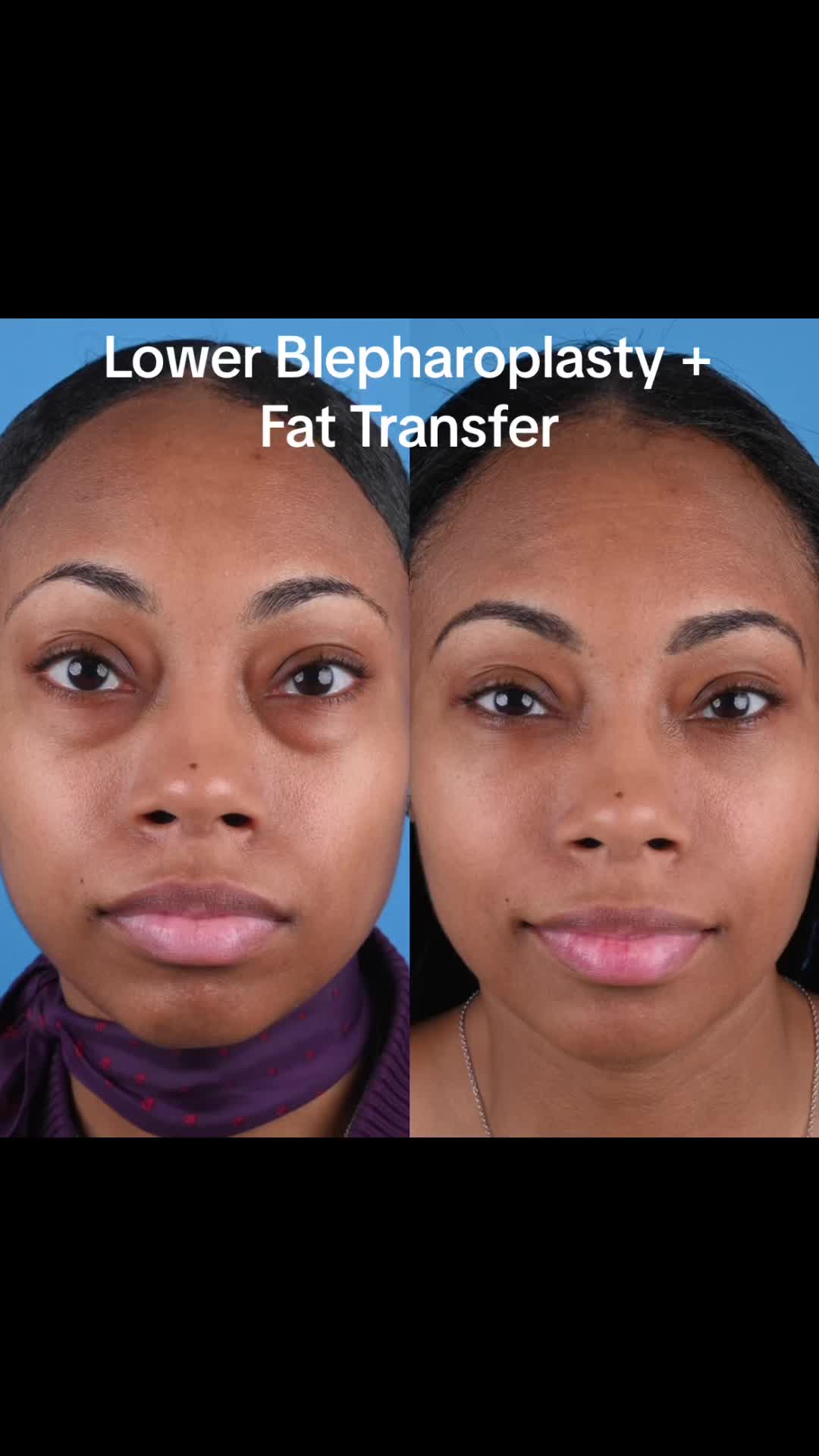 @Dr. Parit Patel, MD