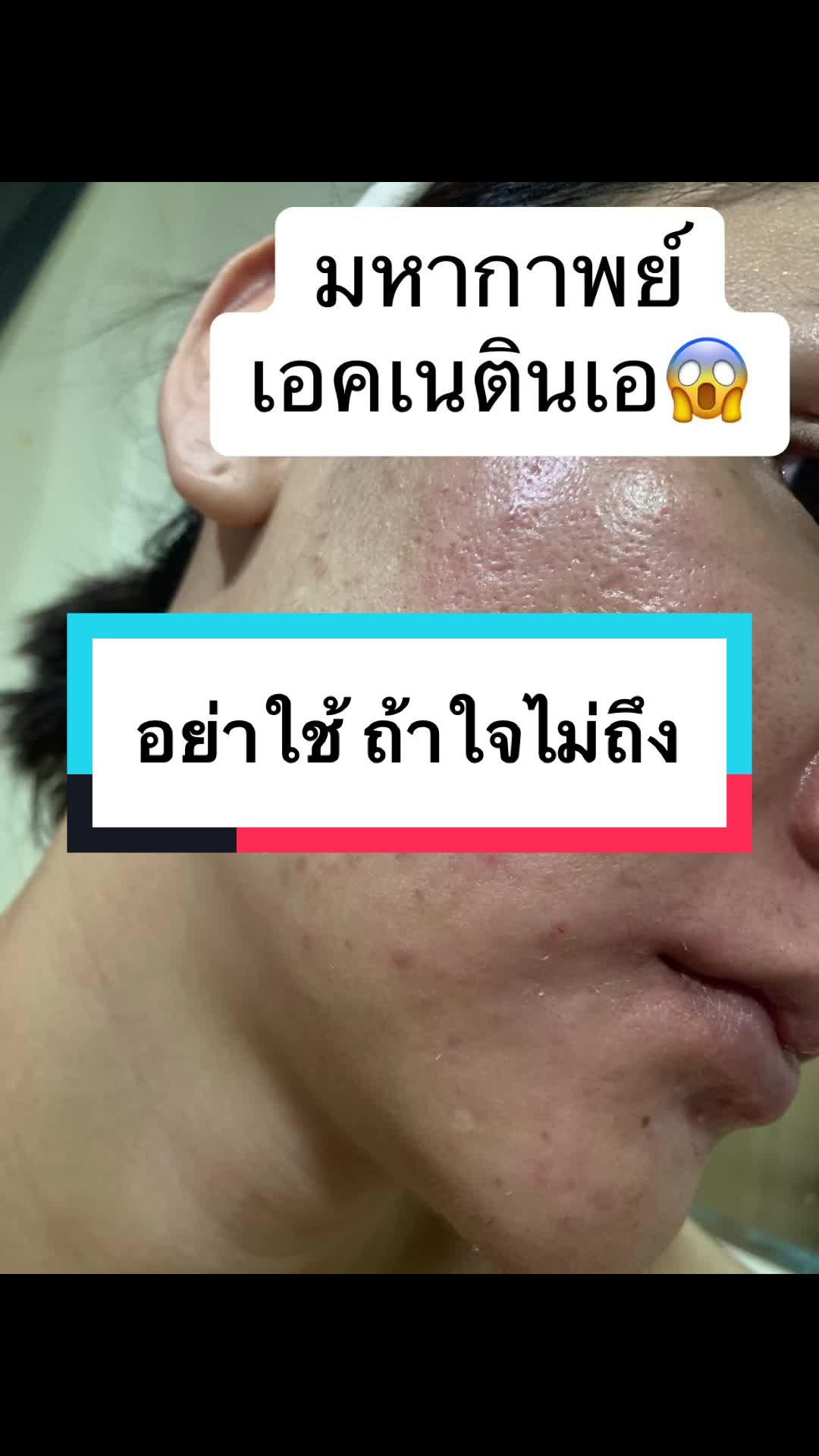 @บลูลอน🩵
