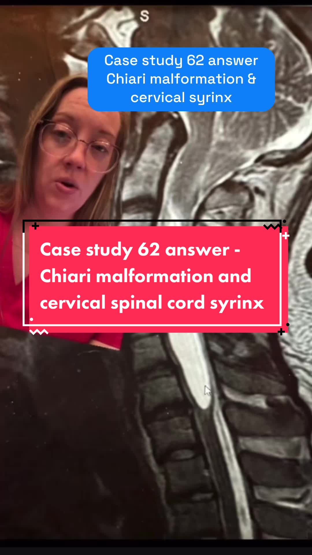 @Ladyspinedoc⚡️