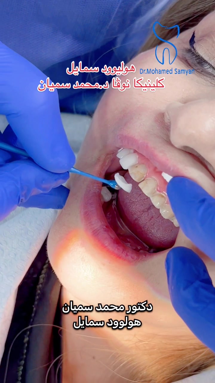 @Dr.Mohamed Samyan