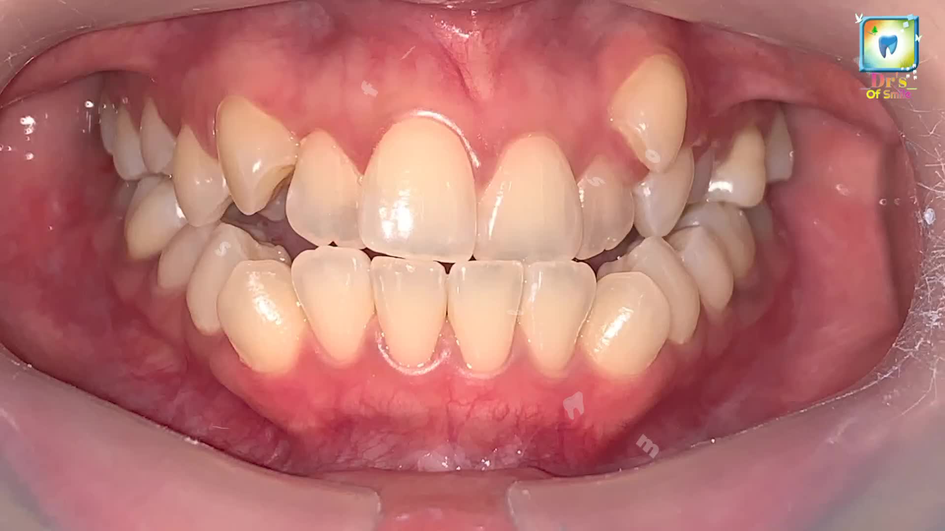 @𝗗𝗿'𝘀 𝗢𝗳 𝗦𝗺𝗶𝗹𝗲🦷🧑‍⚕️