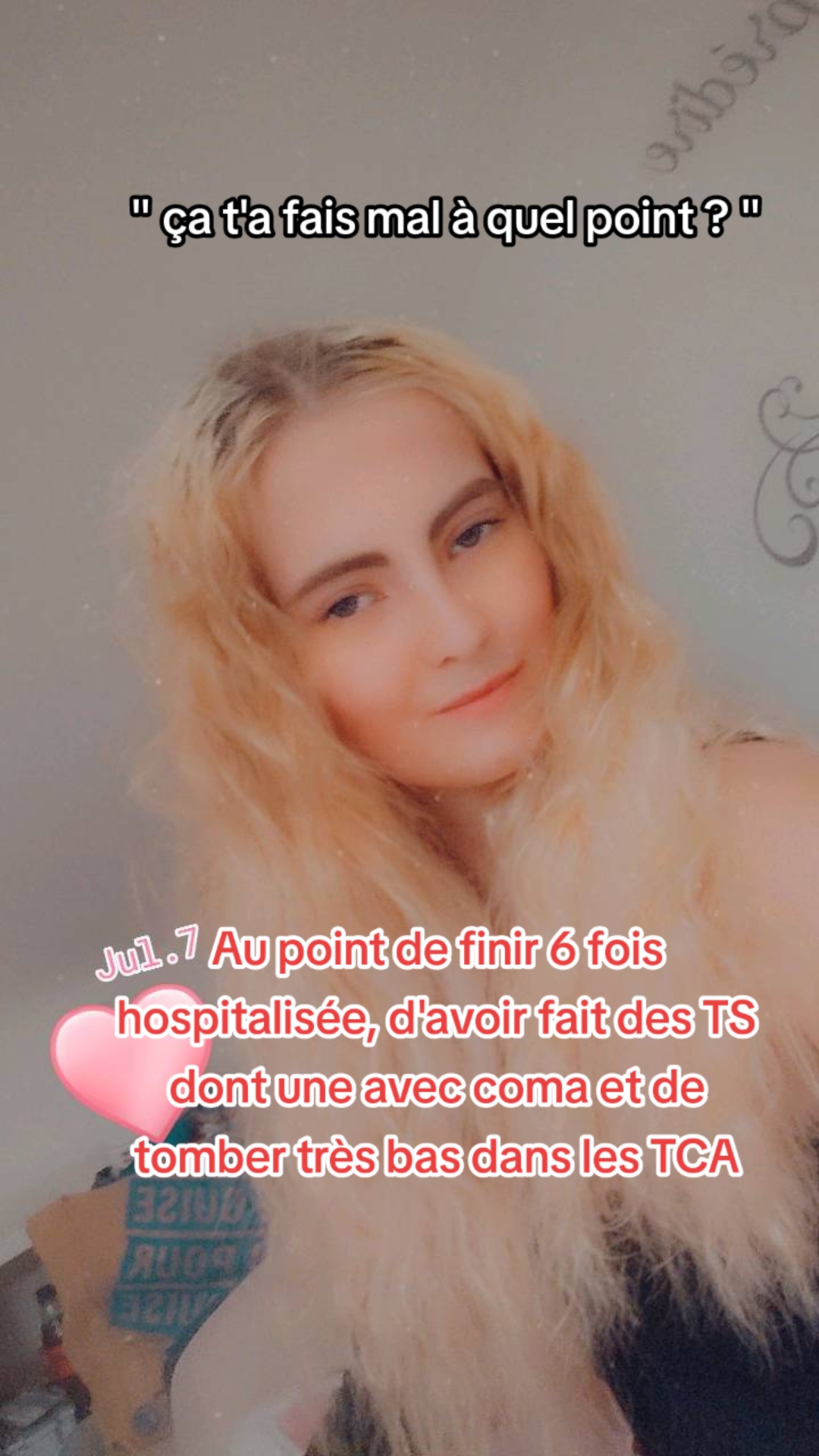 @Ray Laura 🎗️