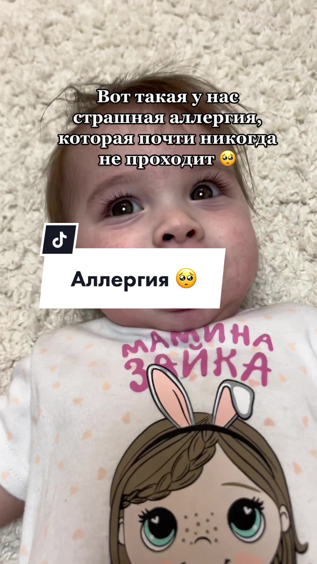 @Shachekeva