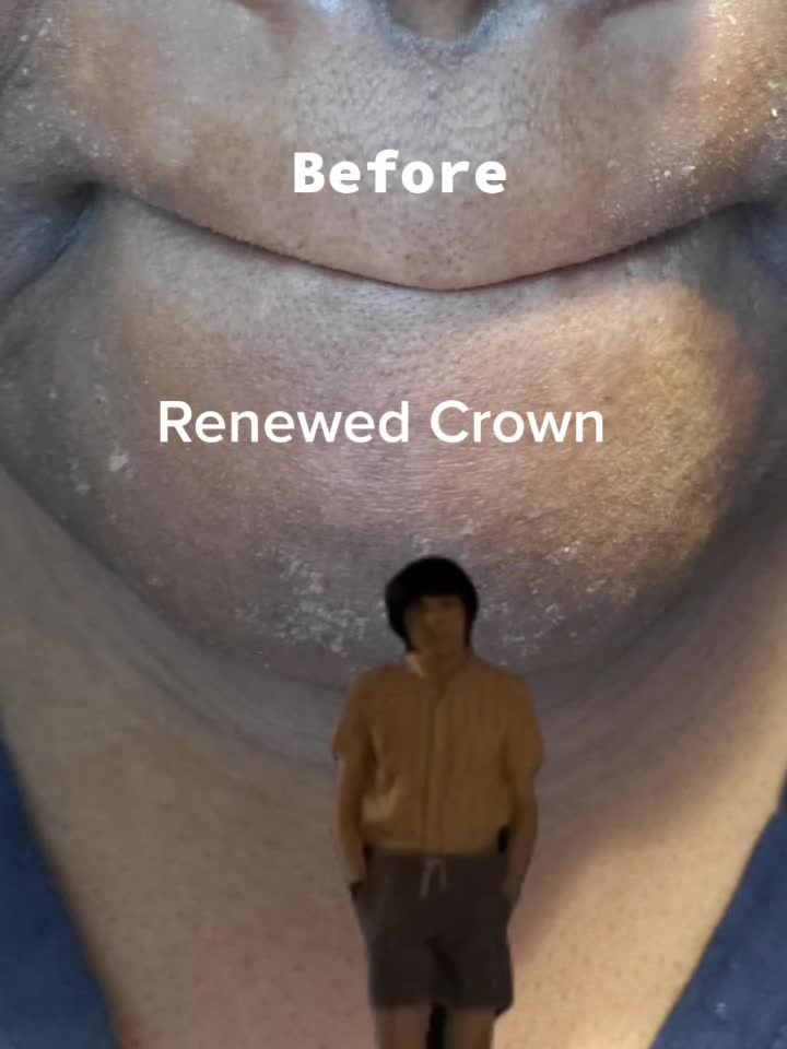 @Renewed Crown. LLC