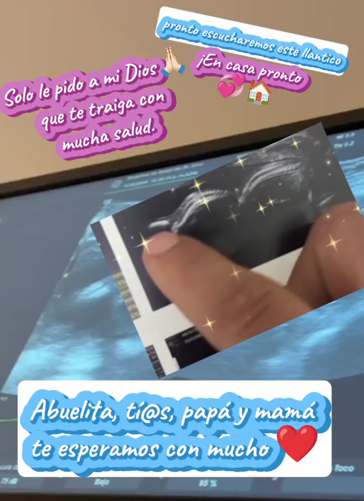 @lolimarbalza🇻🇪🌻