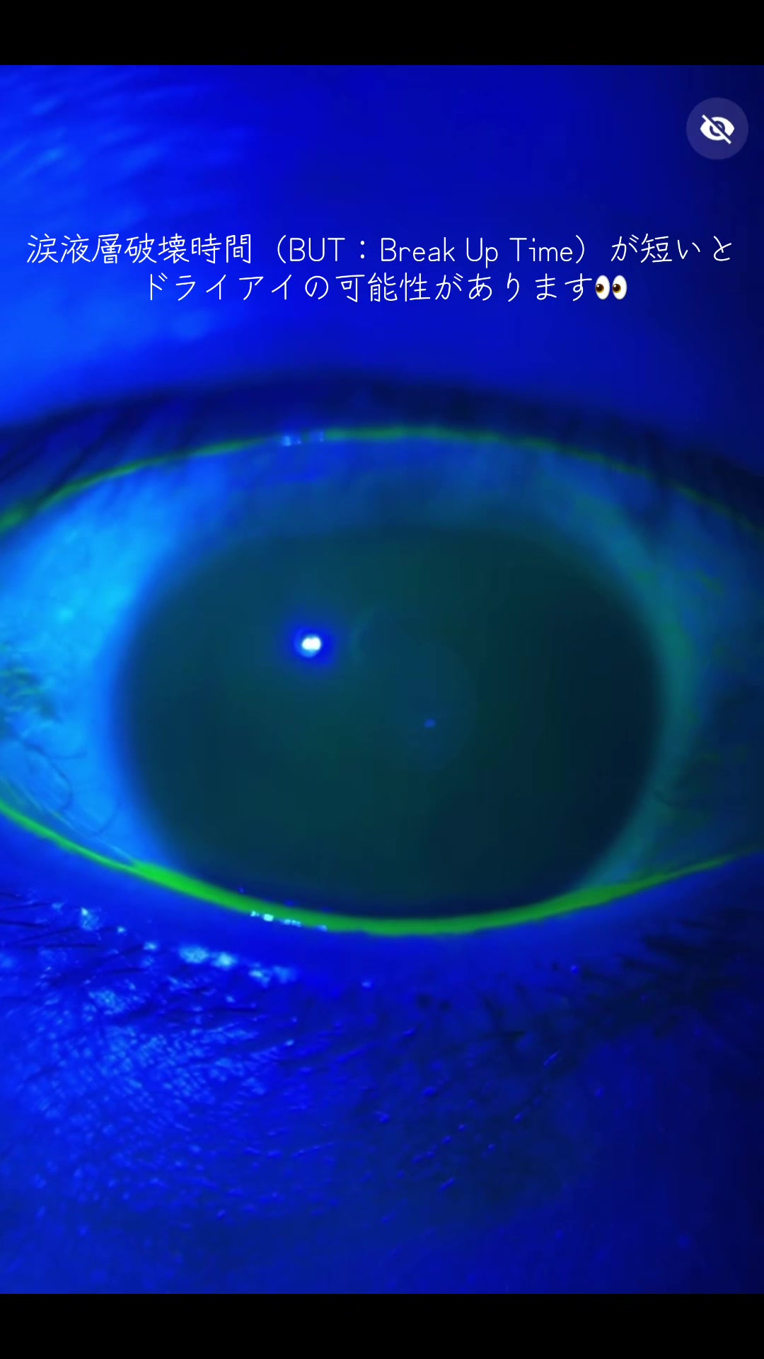 @Hiro｜Orthoptist