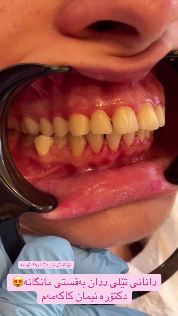 @🦷 دکتۆرە ئیمان کاکەمەم