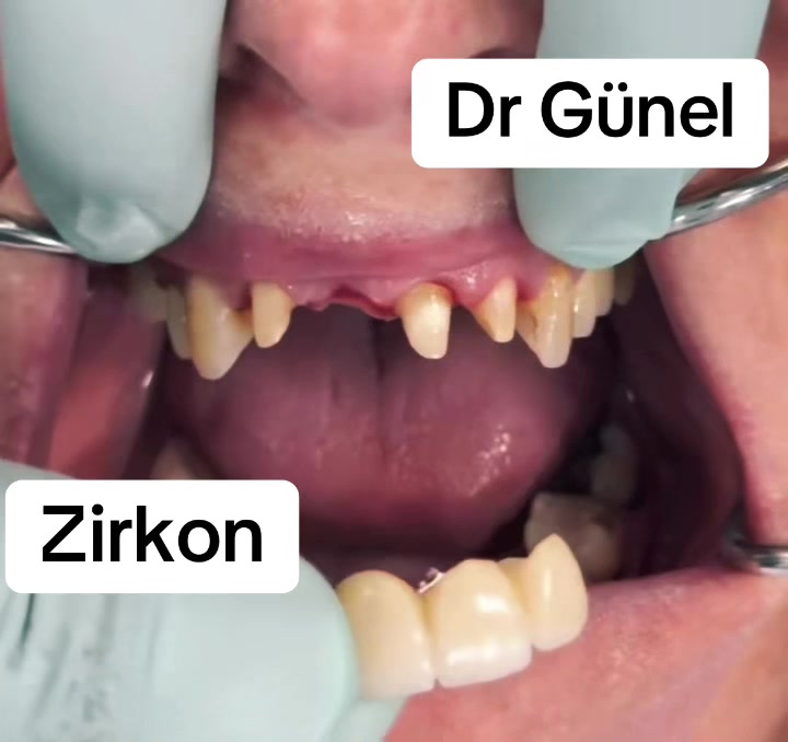 @Dentist_G&uuml;nel
