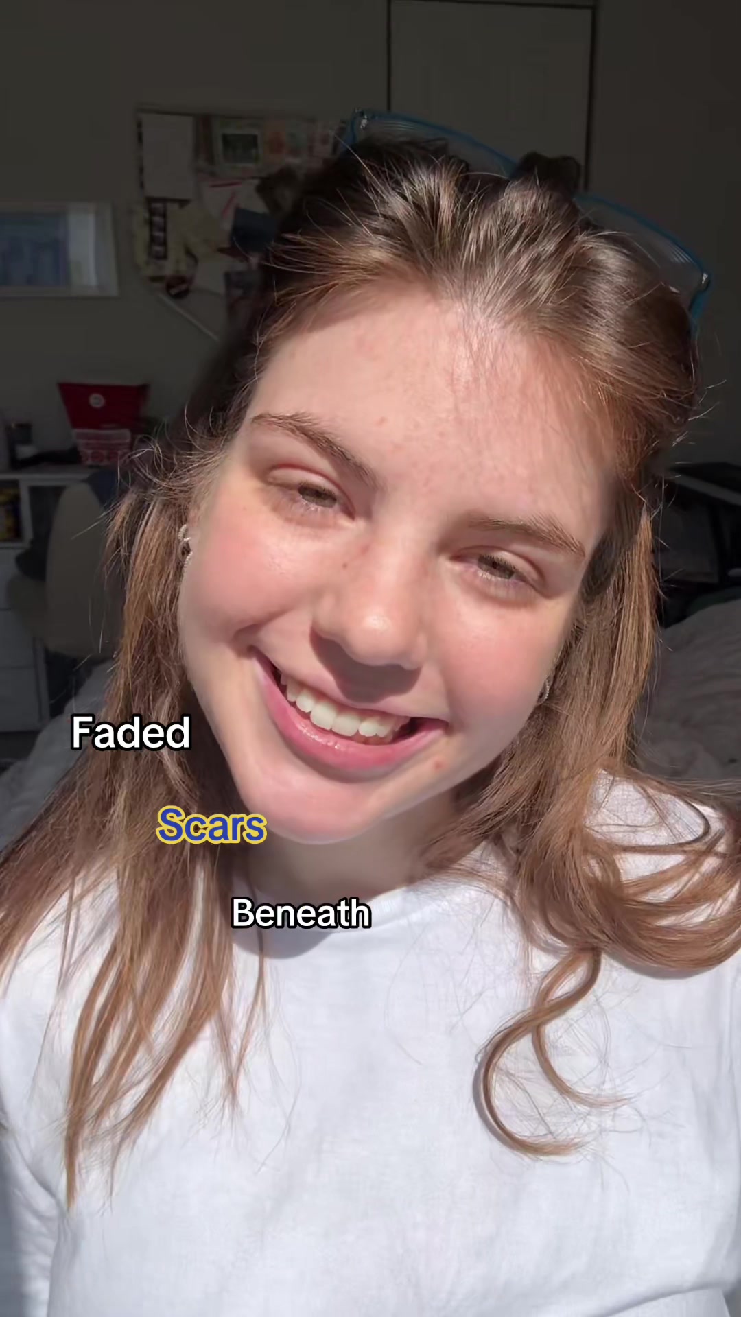 @Emma