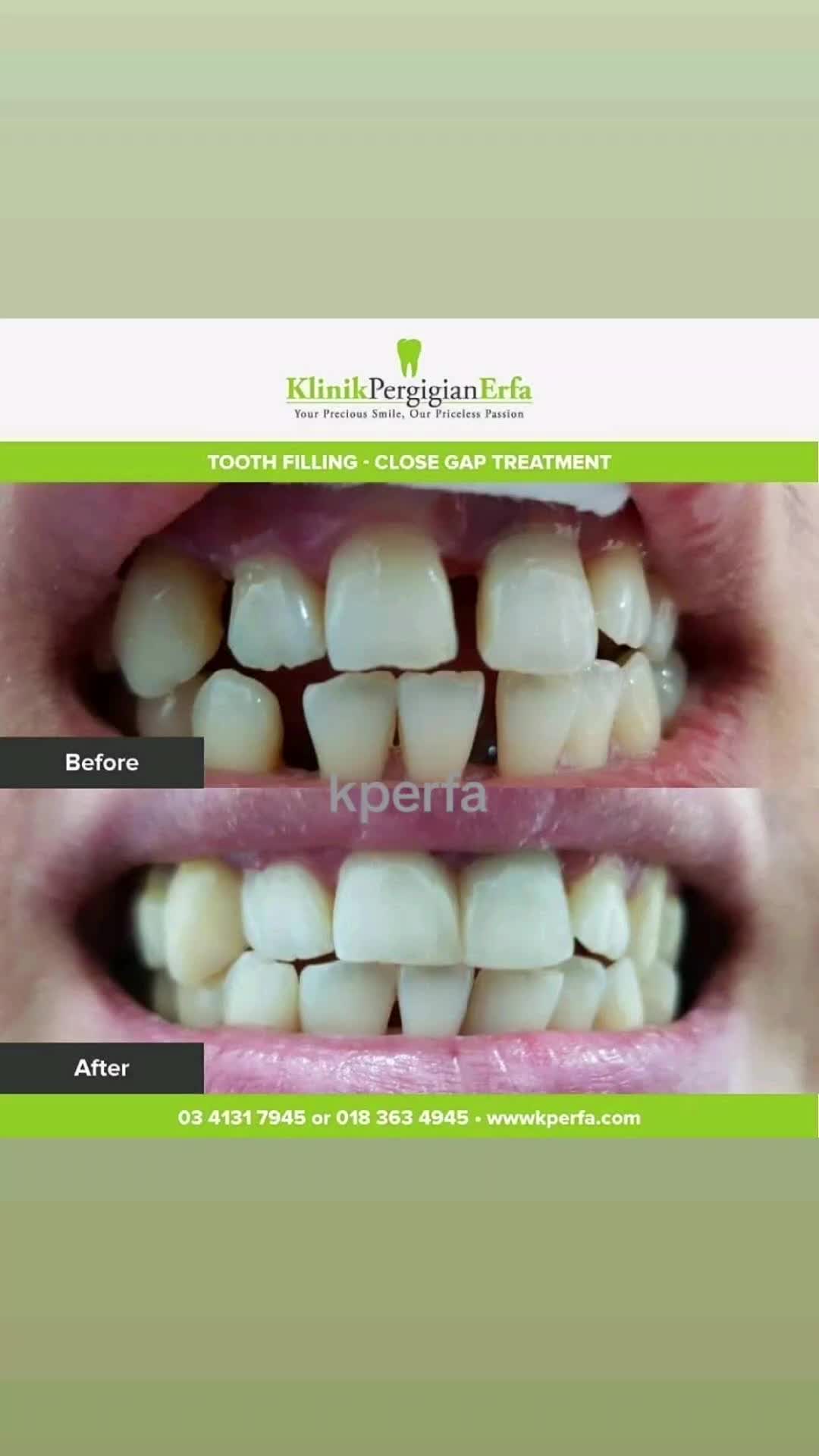 @Klinik Pergigian Erfa