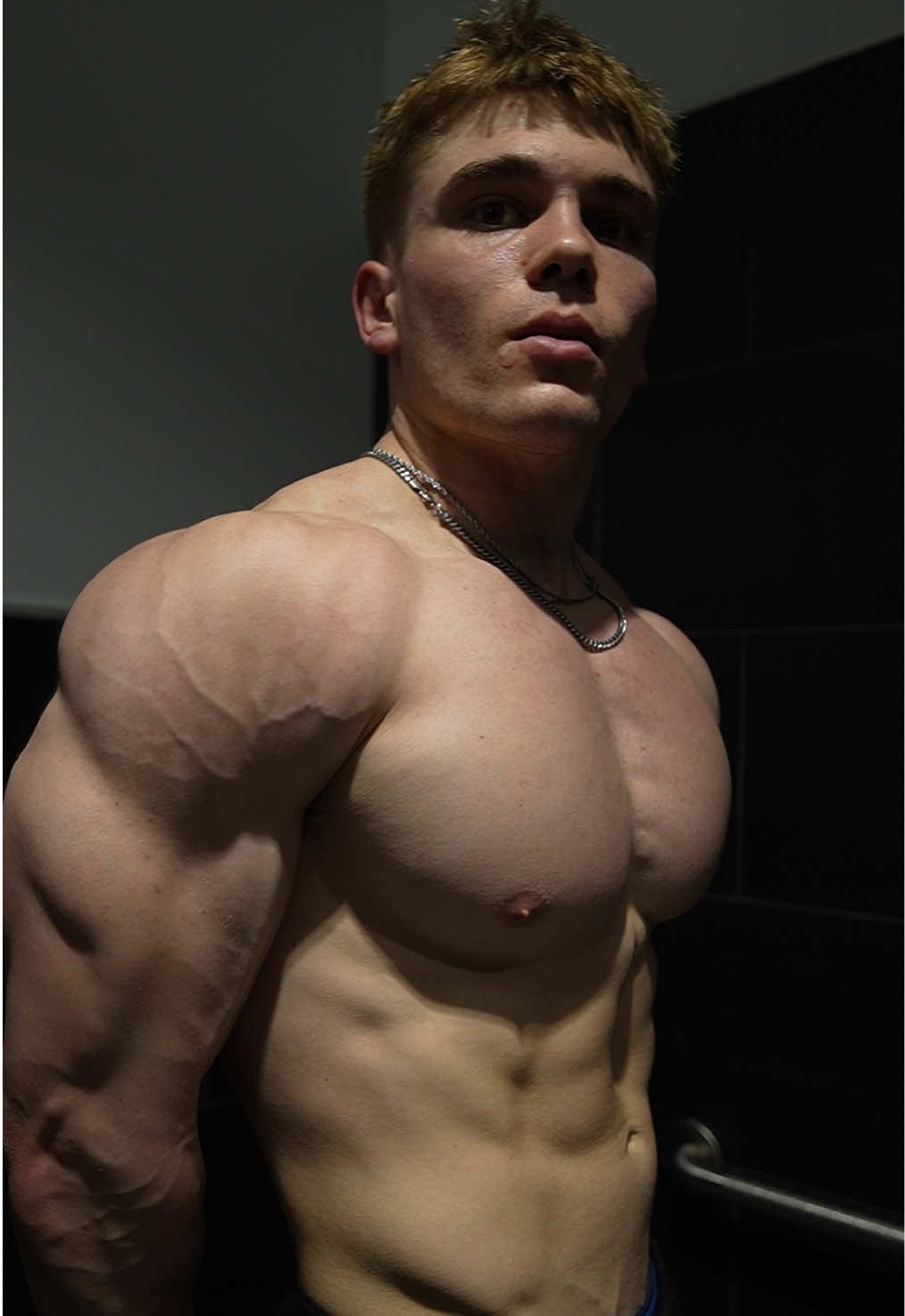 @CaseLifts_