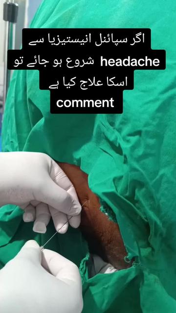@propofol 💉