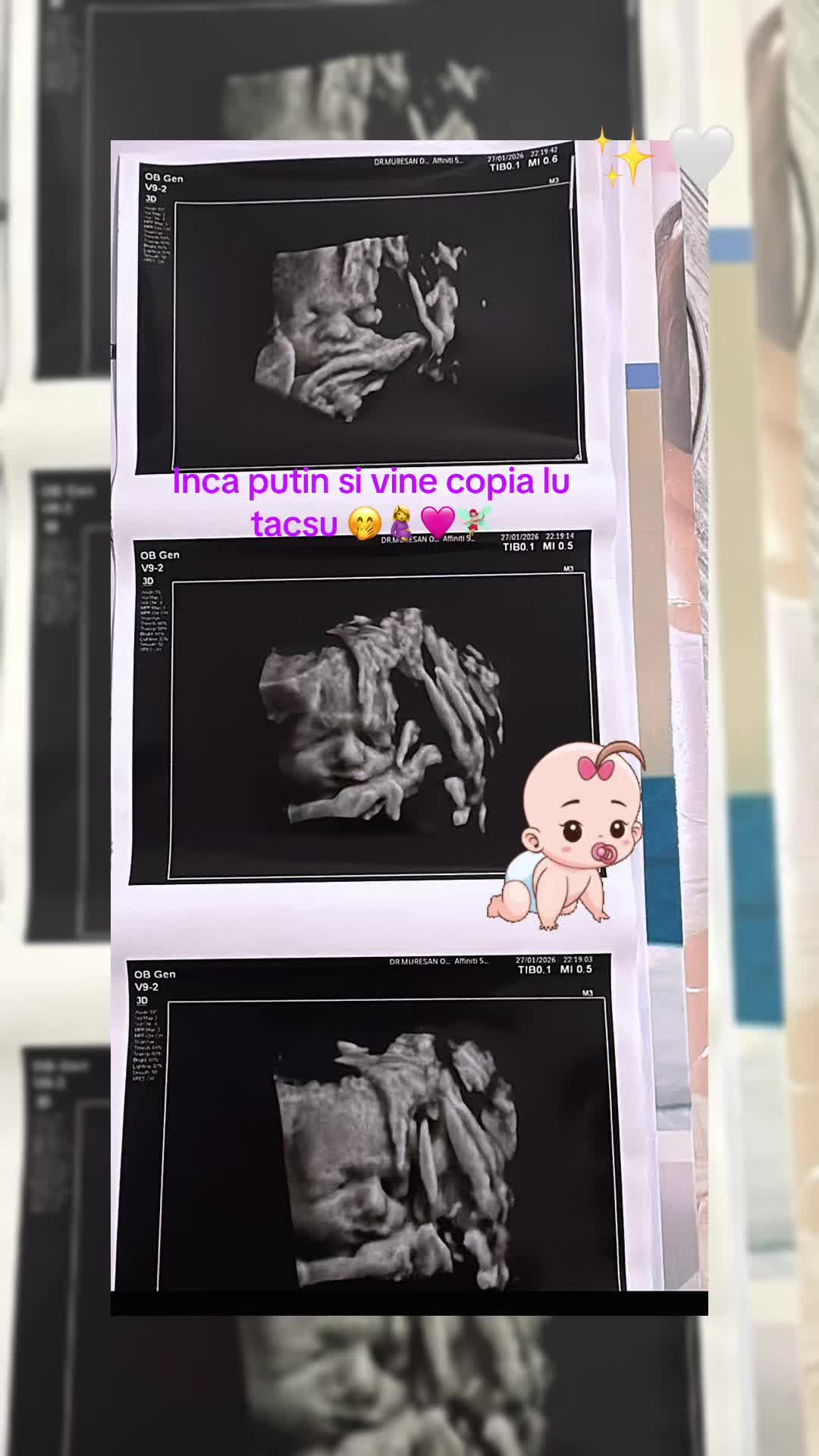 @Mihaeela