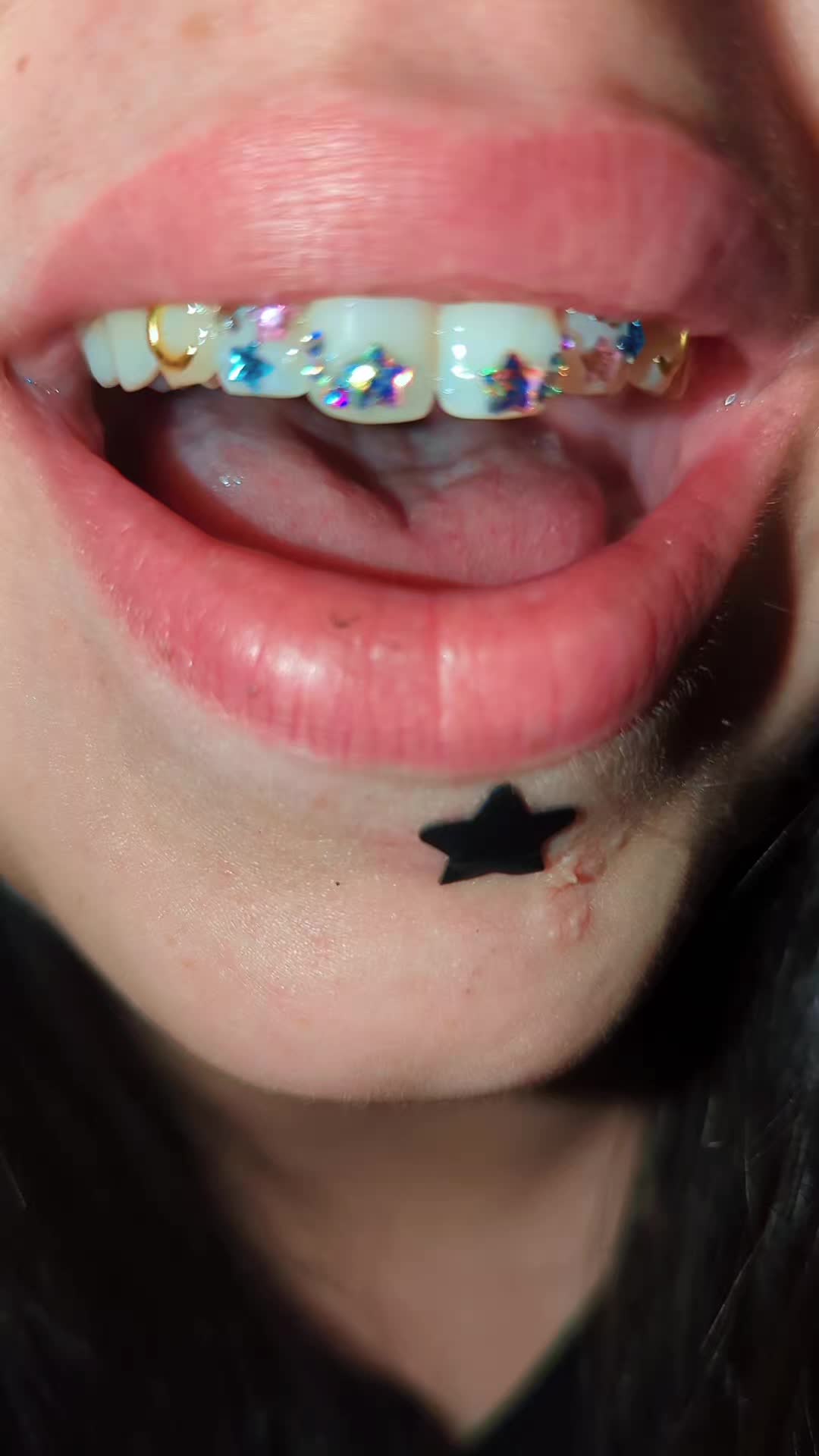 @✨🍒🅺🆈🅻🅴🅴🍒✨
