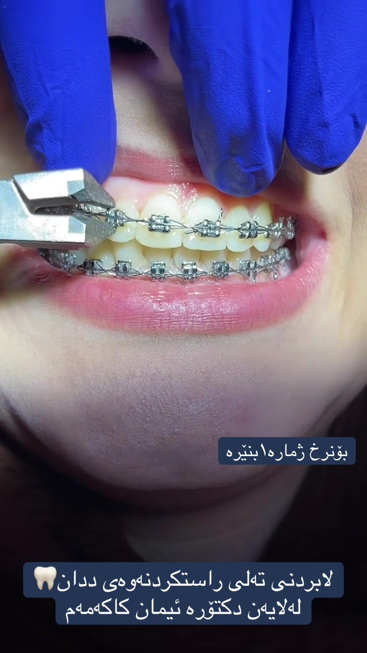 @🦷 دکتۆرە ئیمان کاکەمەم