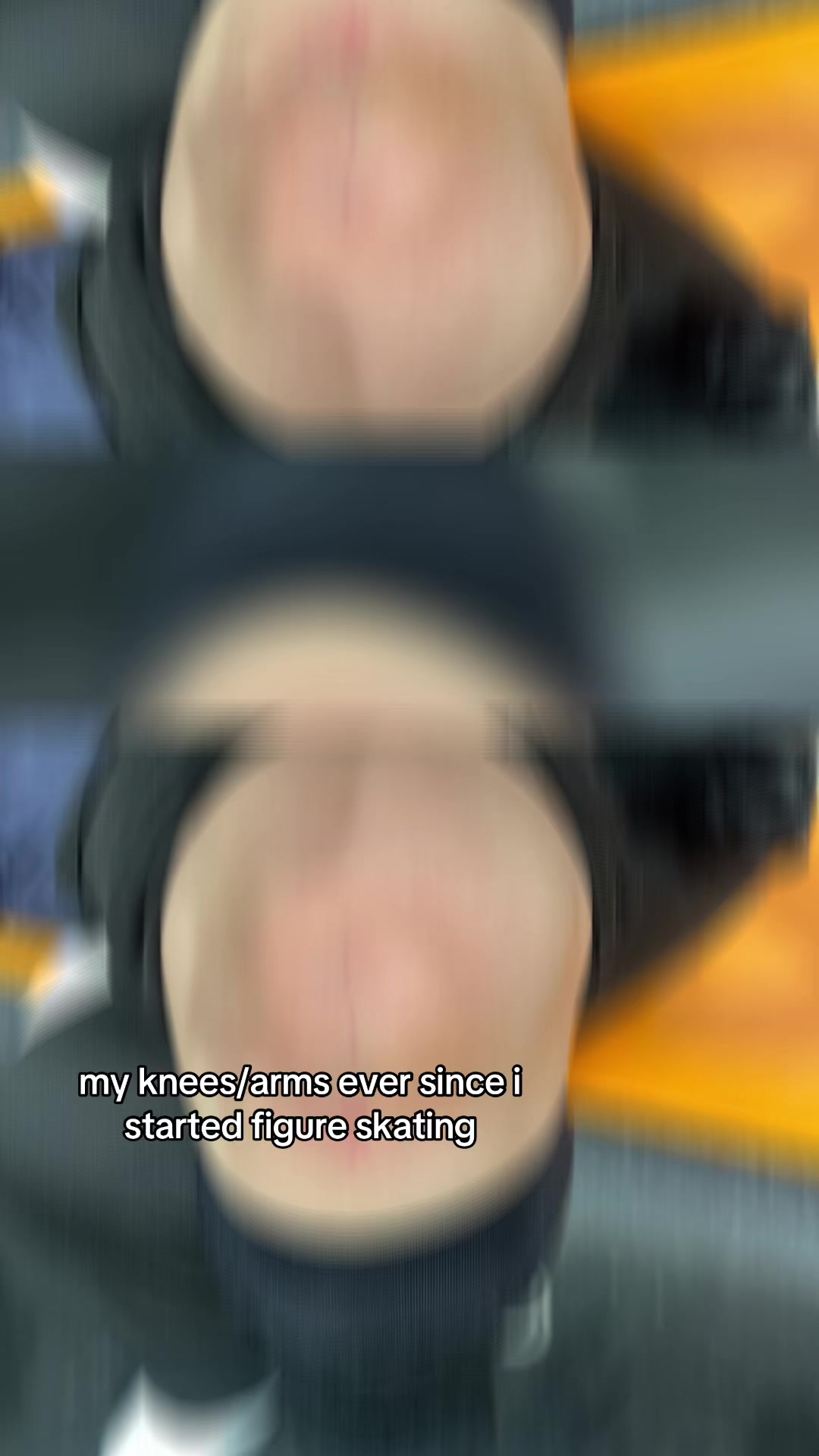 @rn