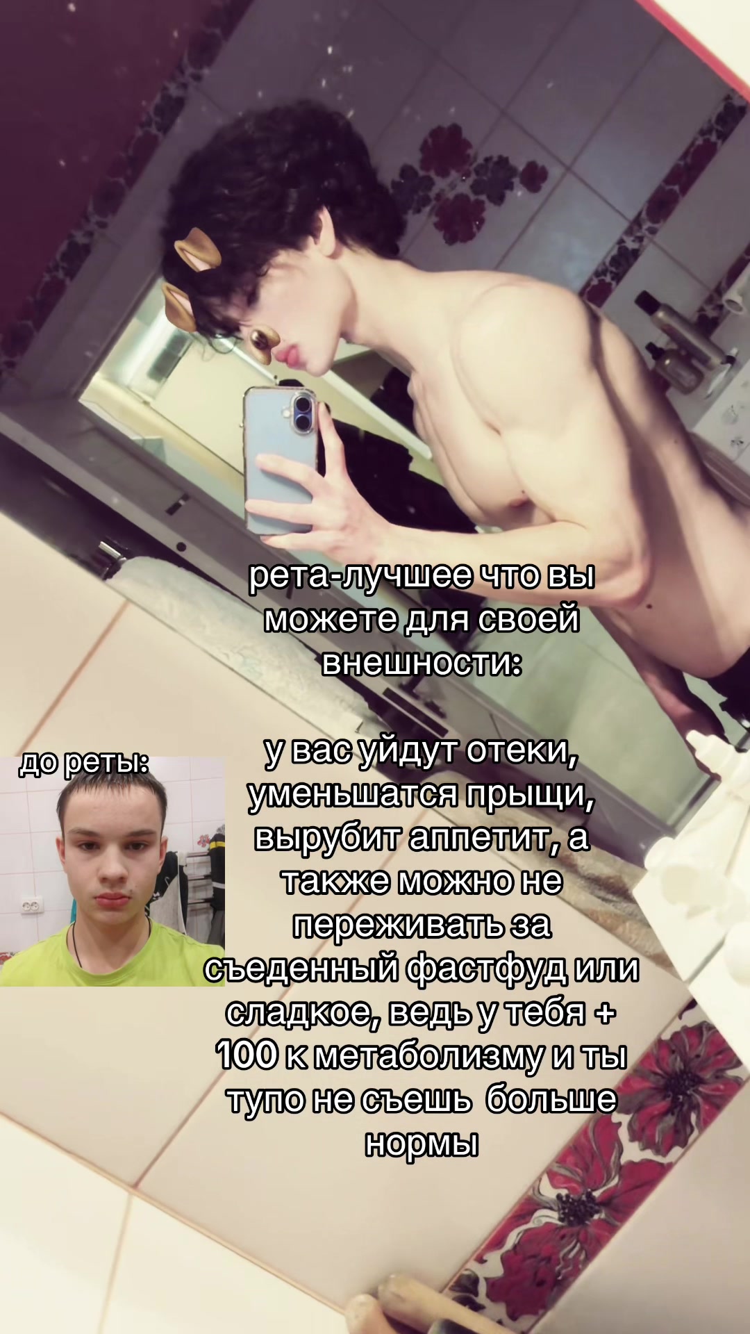 @SkeletonBoy