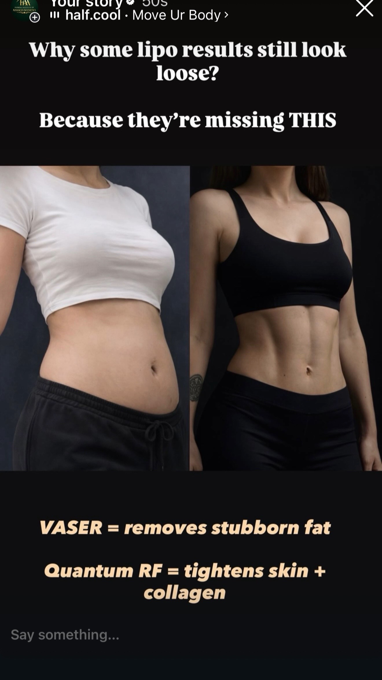 @FIAA | Advanced Aesthetics