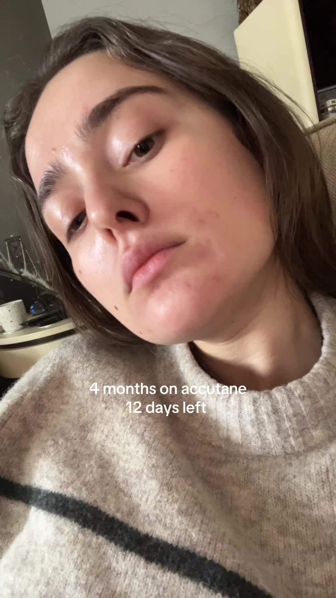 @andreea_skintok