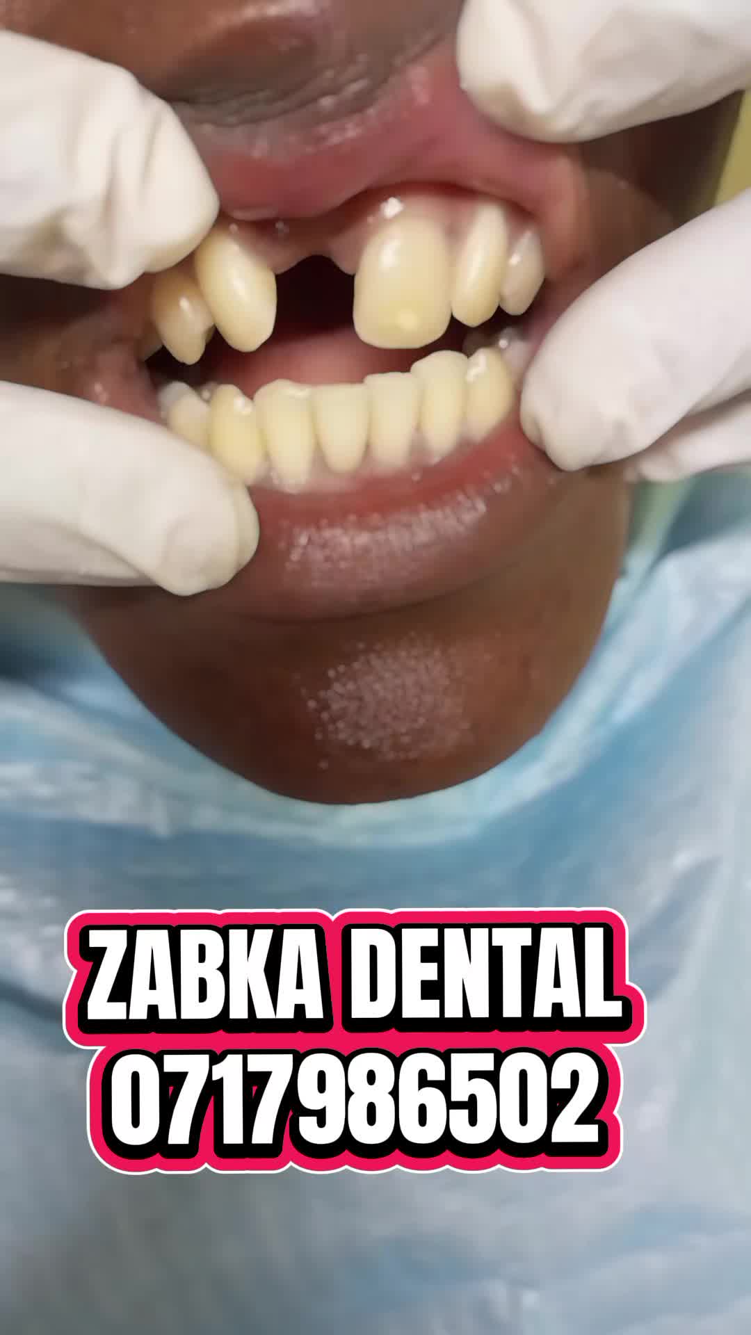 @Zabka Dental