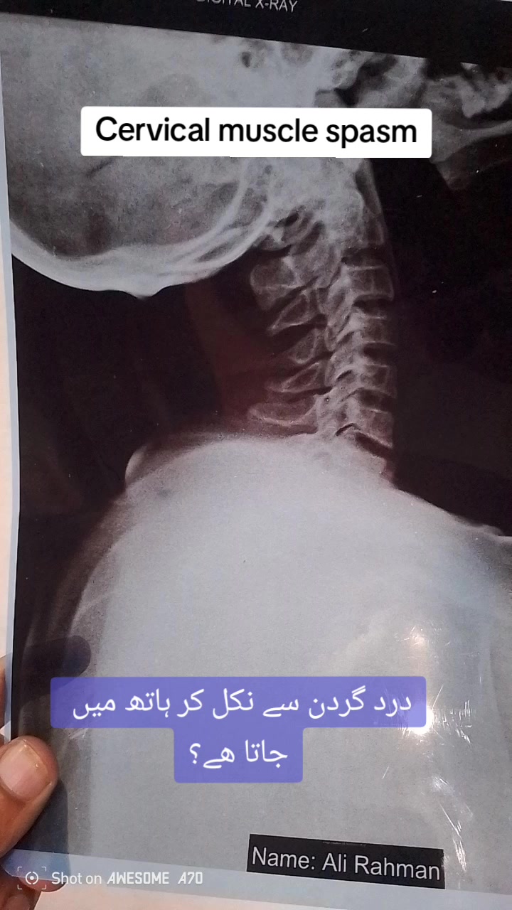 @Dr wadood