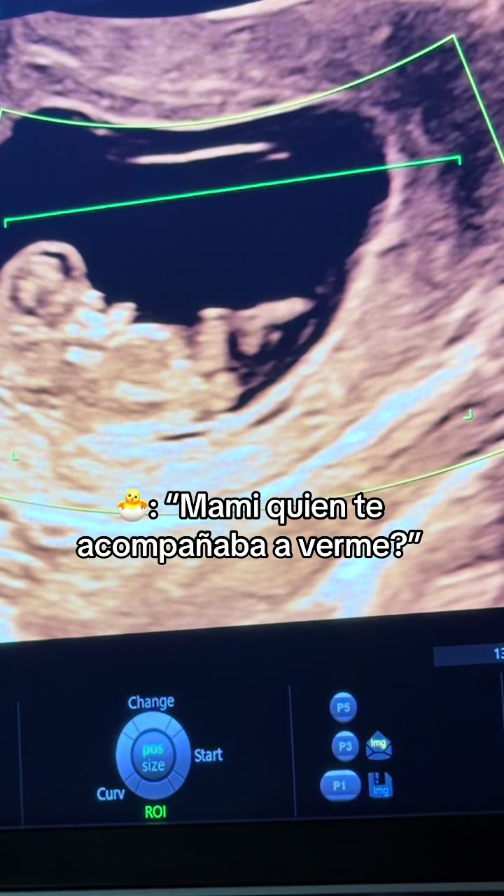 @Karen Barrera