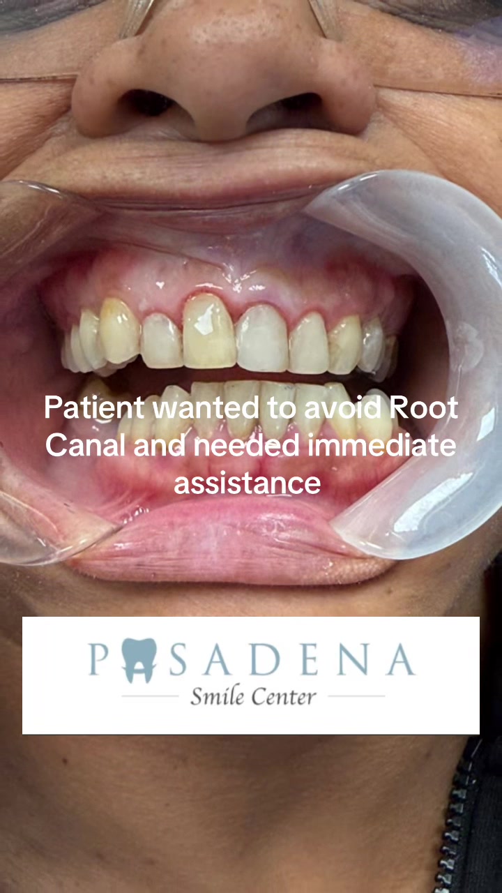 @Pasadena-dentist