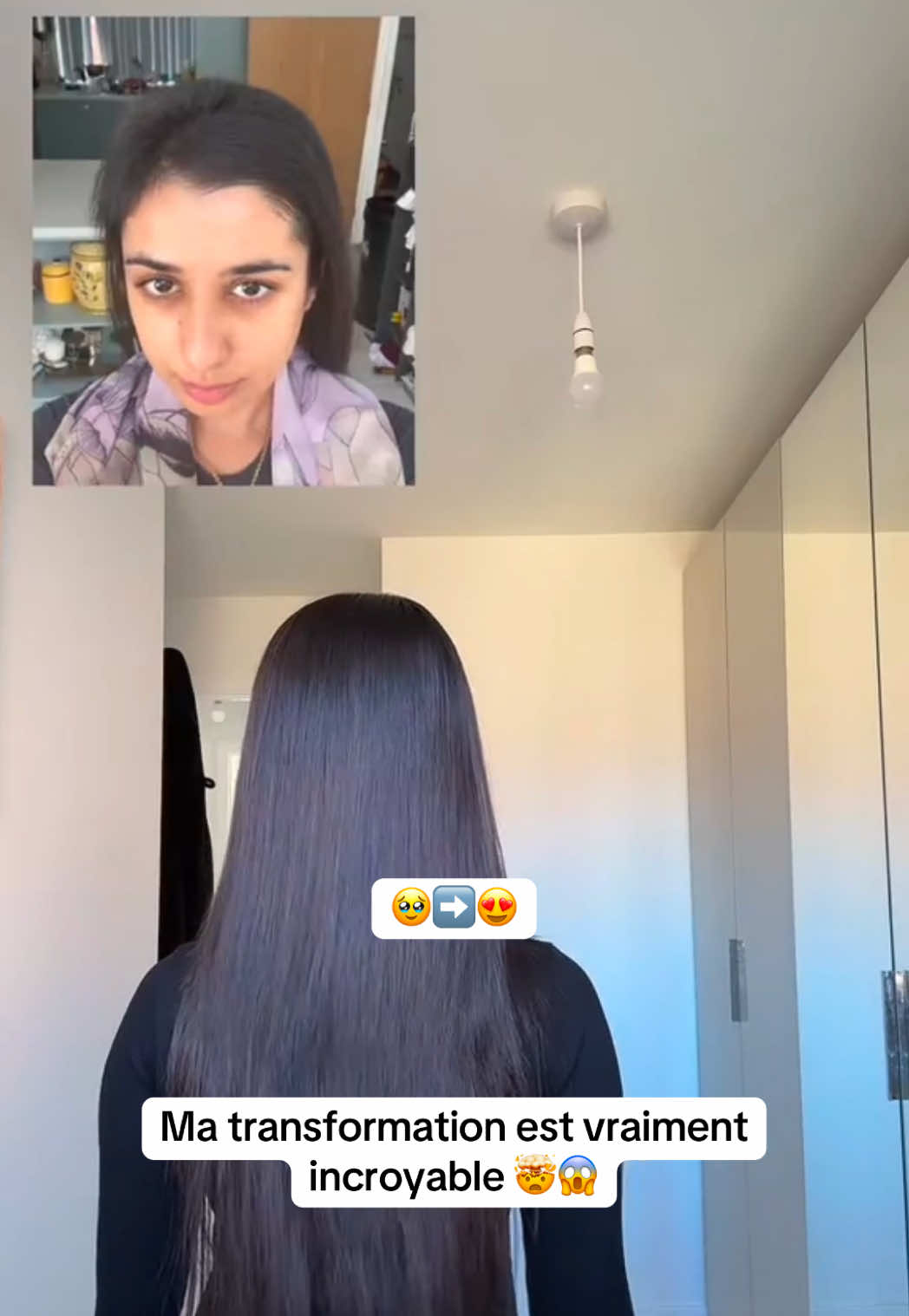 @Lux&rsquo;Hair Growth FR