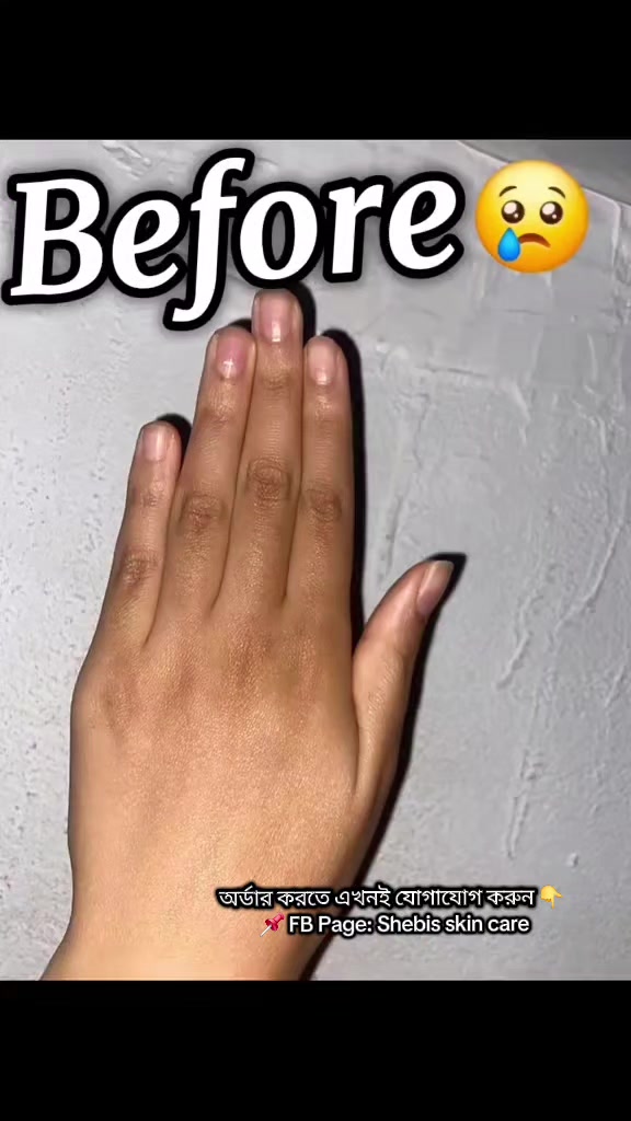 @Shebis skin care